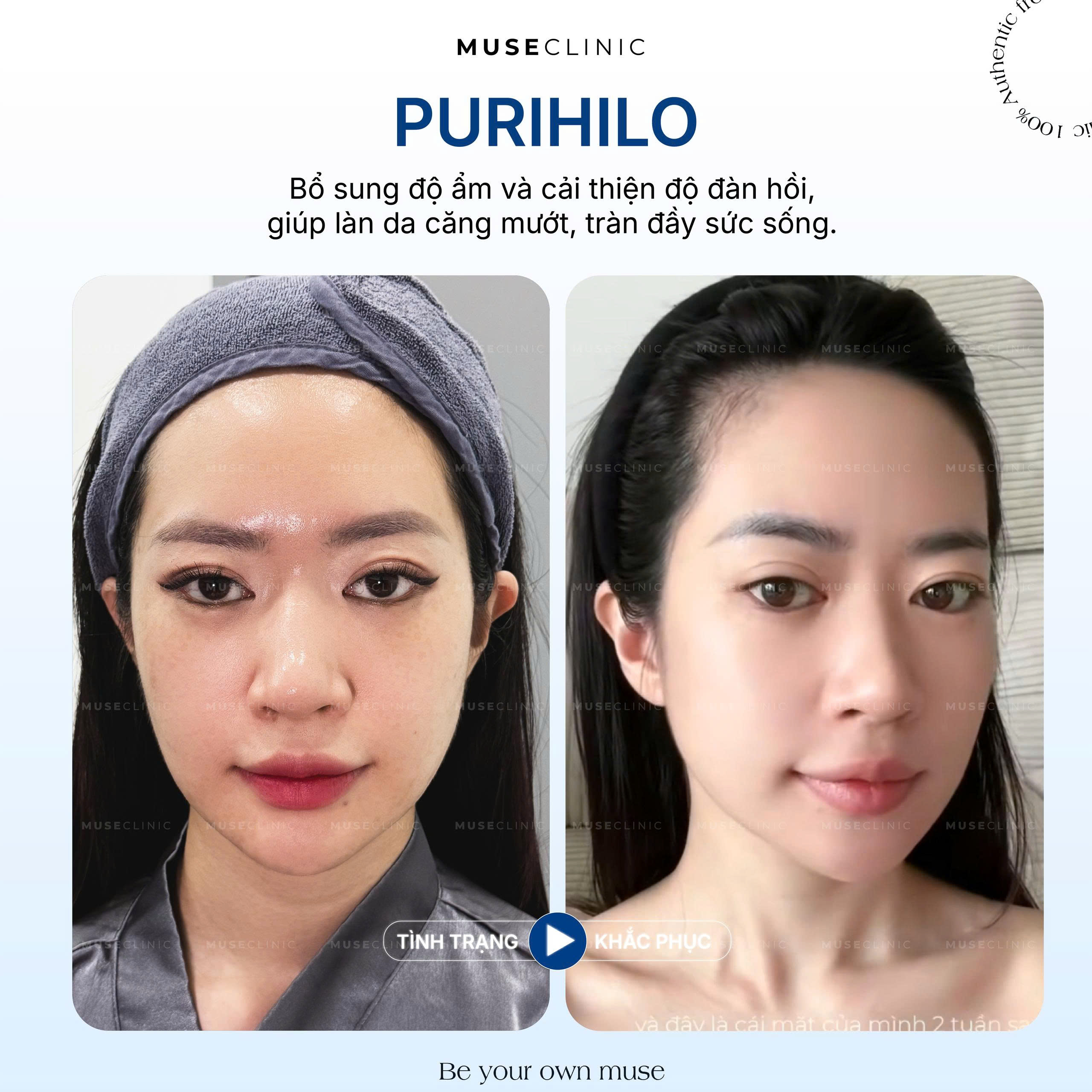 Đan Chi - Á Hậu, Người Mẫu