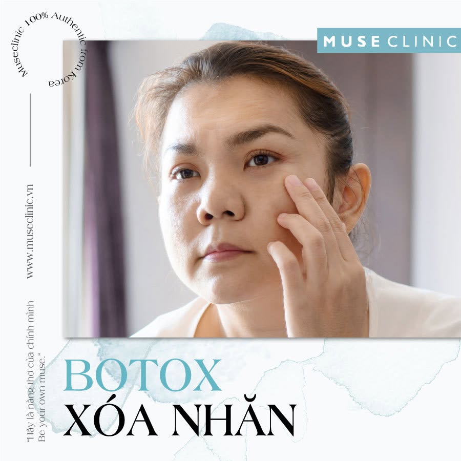 Botox xóa nhăn giữ được bao lâu? Khi nào nên tiêm dặm lại?