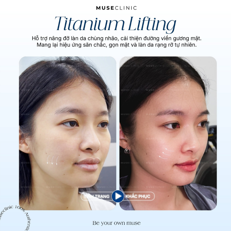 Kim Khánh - Diễn Viên, Ca Sĩ