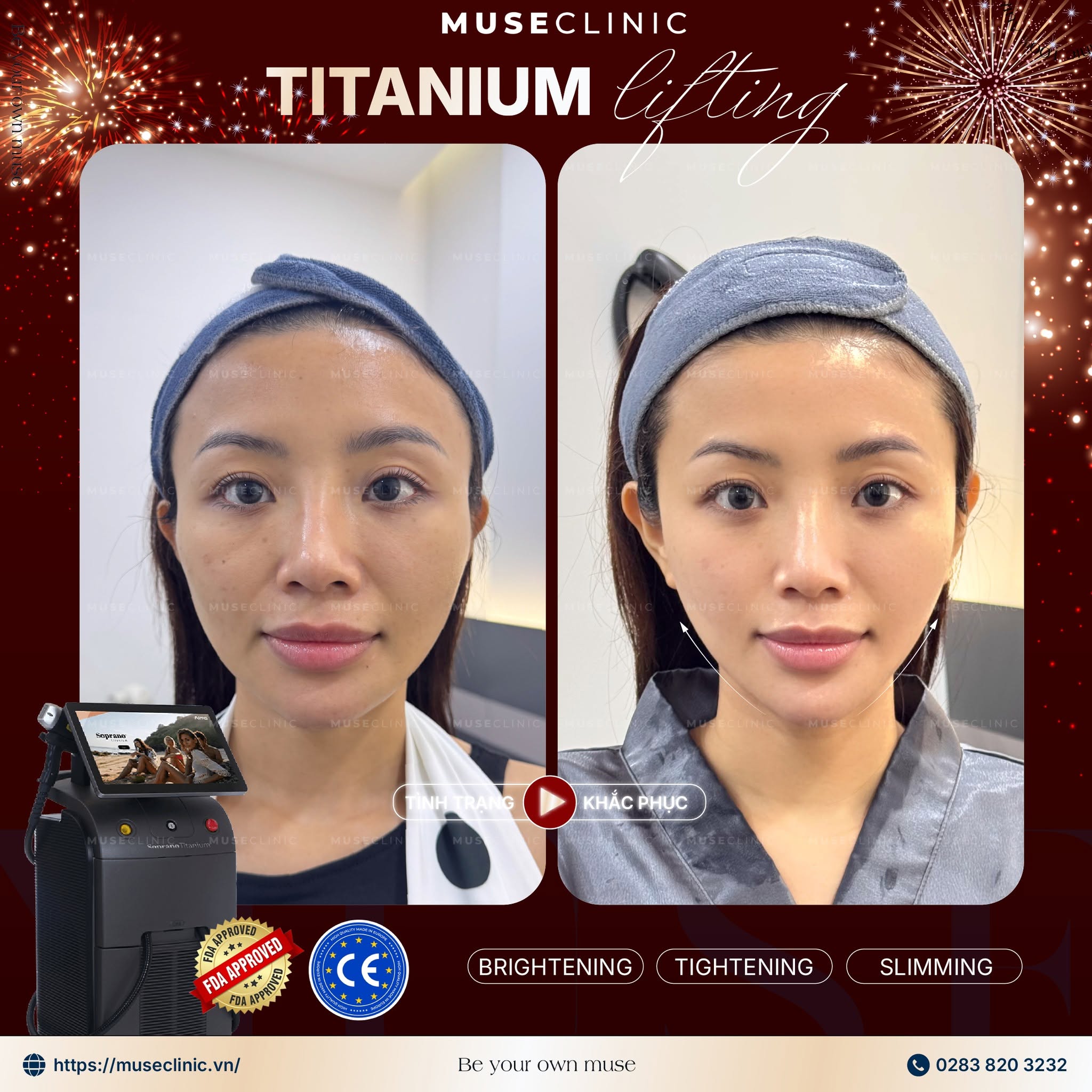 Nhee Phan - Mẫu Ảnh, Hot Instagram 