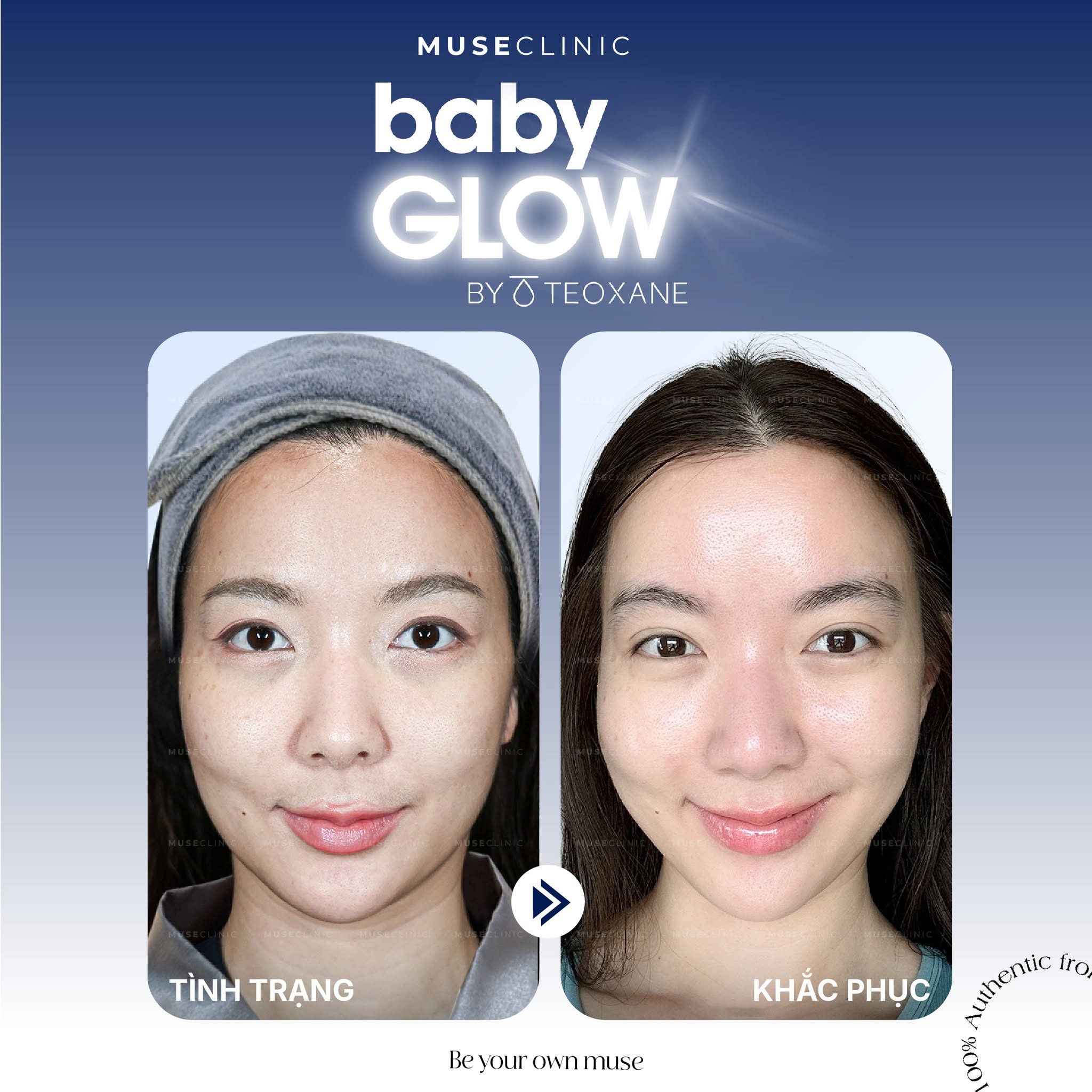 Baby Glow có giúp da căng bóng như idol Hàn? Giải đáp 5 vấn đề làn da thường gặp