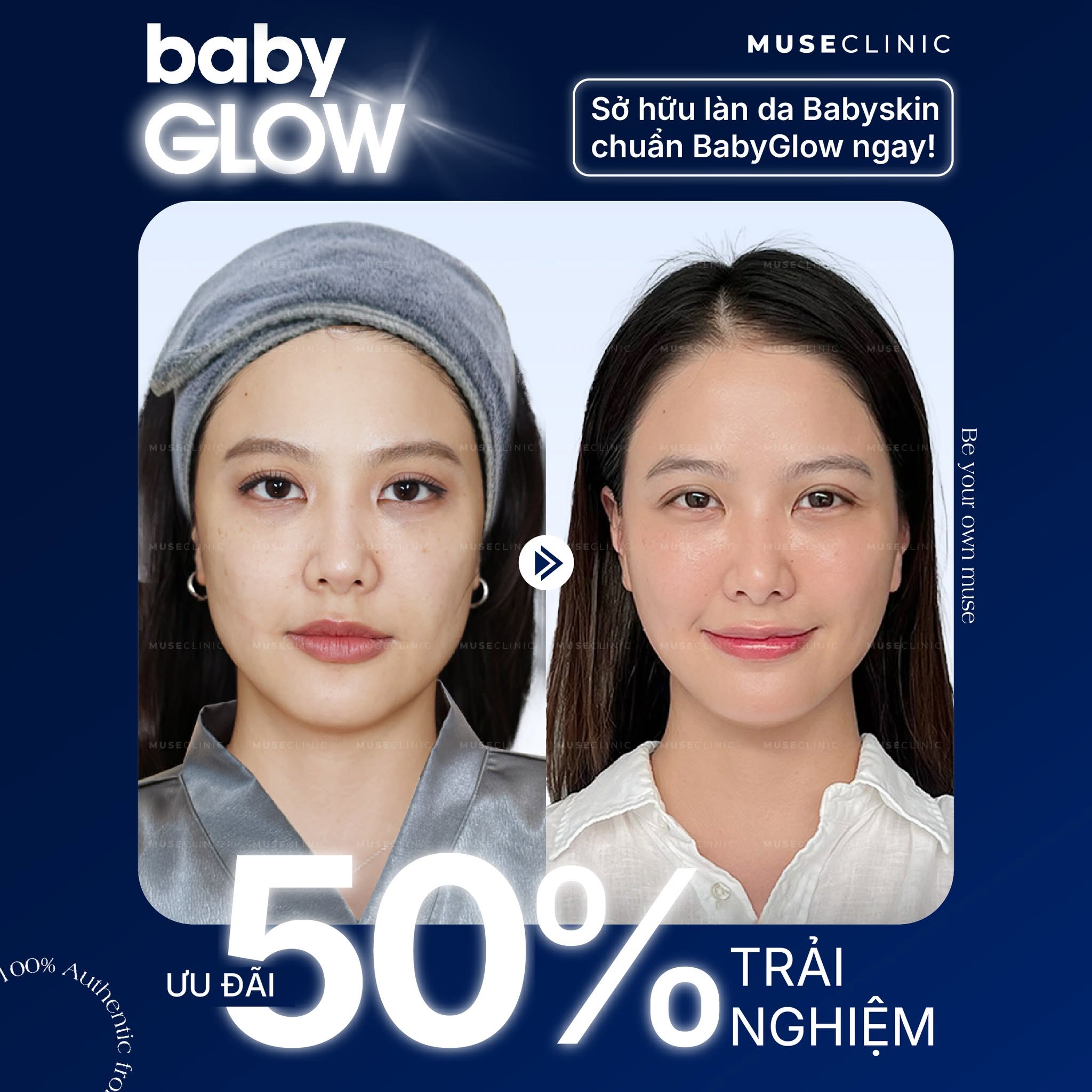 Baby Glow có giúp da căng bóng như idol Hàn? Giải đáp 5 vấn đề làn da thường gặp