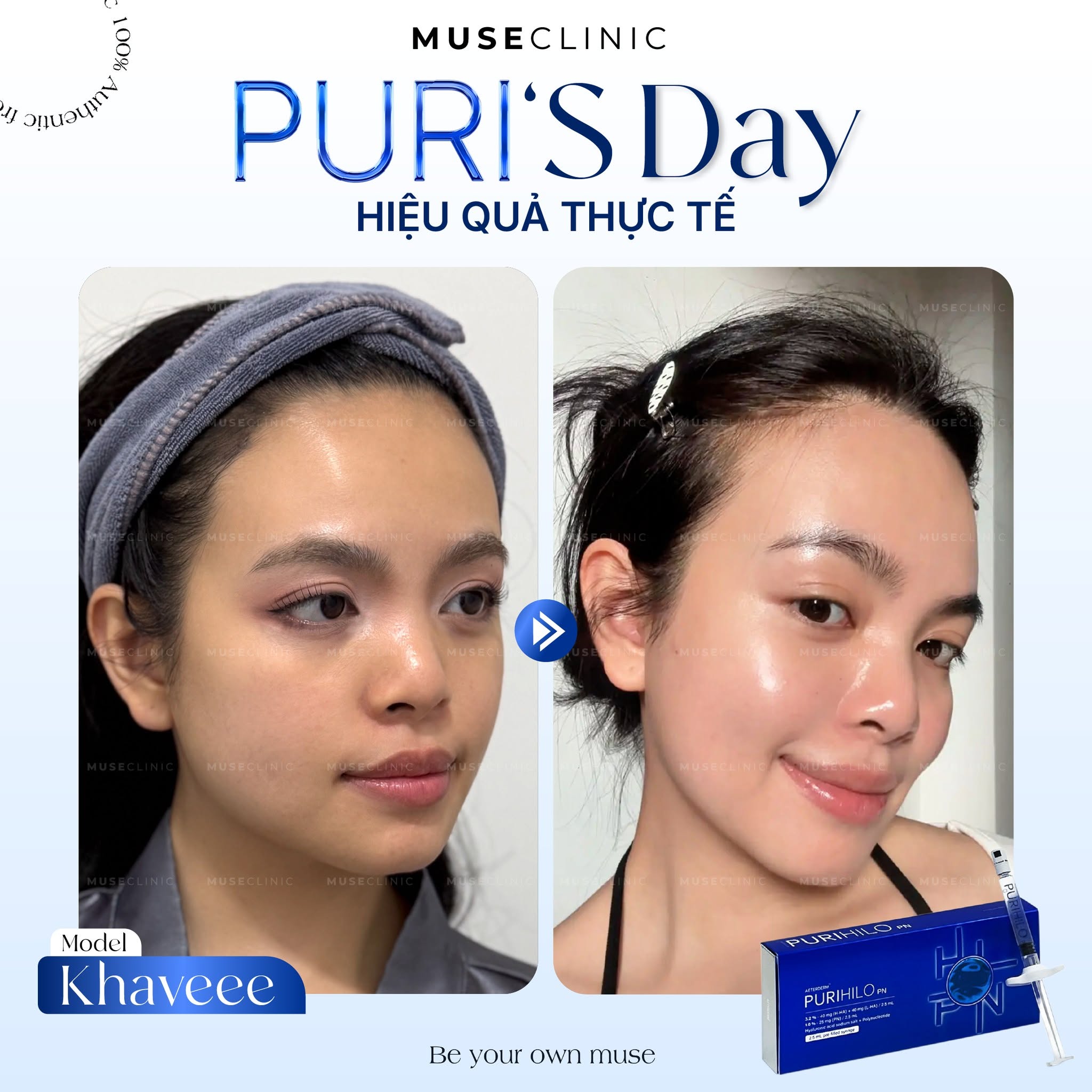 Khaveee - Mẫu Ảnh Tự Do