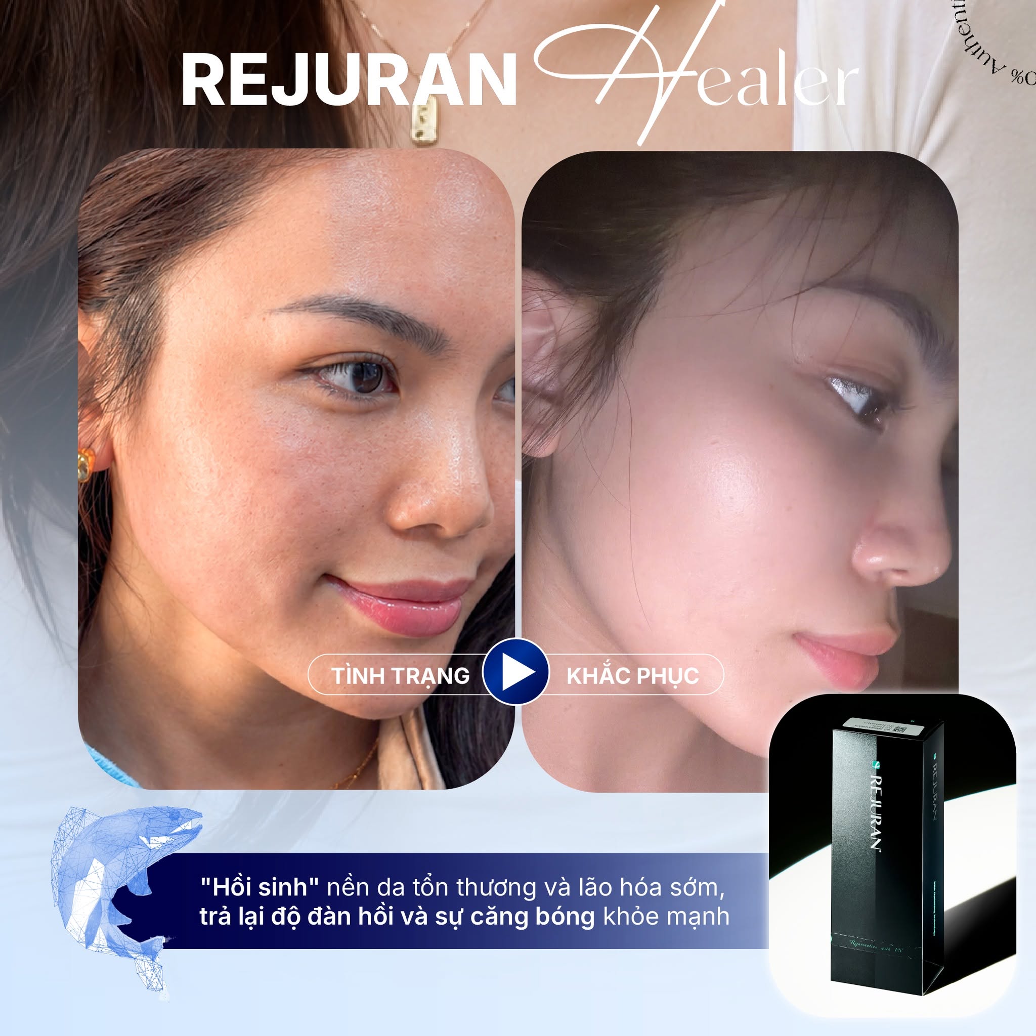 Rachel Phan - Ca sĩ, Người Mẫu