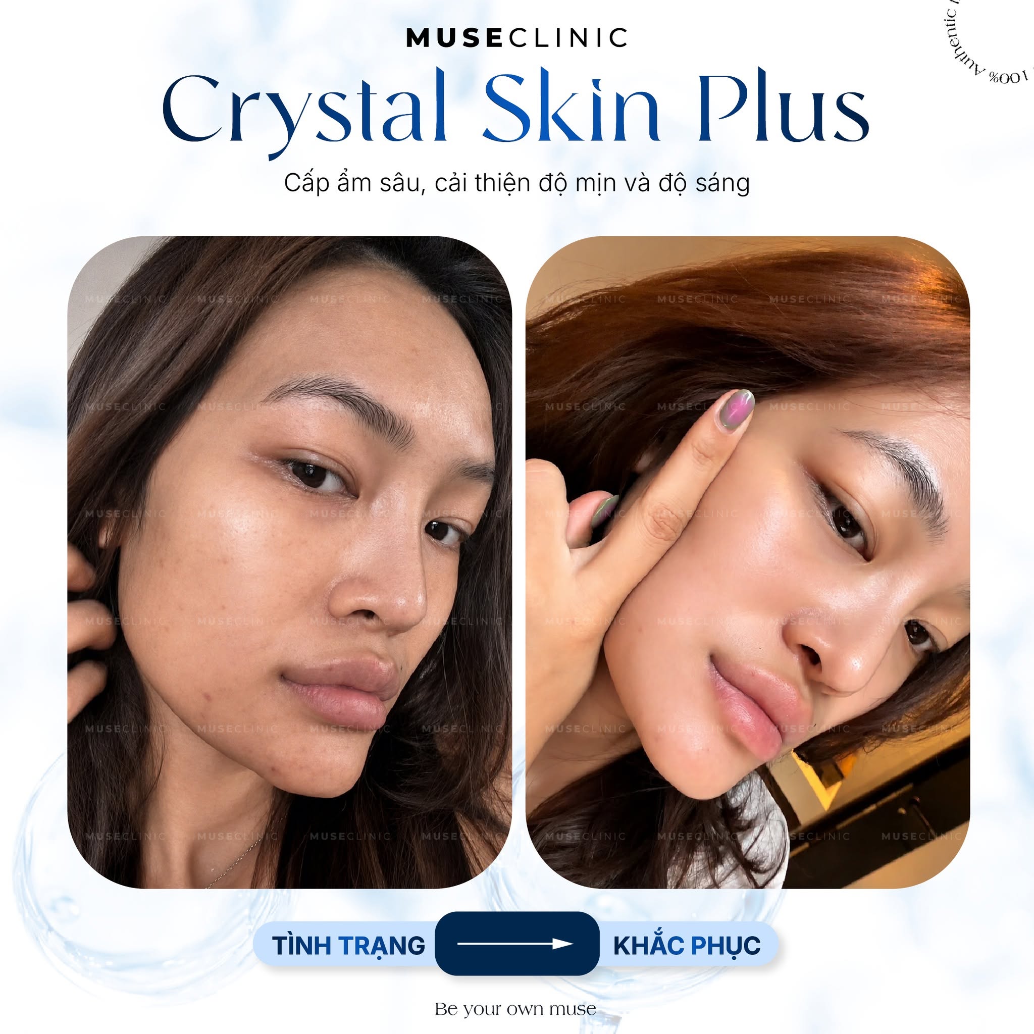 Baby Glow có giúp da căng bóng như idol Hàn? Giải đáp 5 vấn đề làn da thường gặp