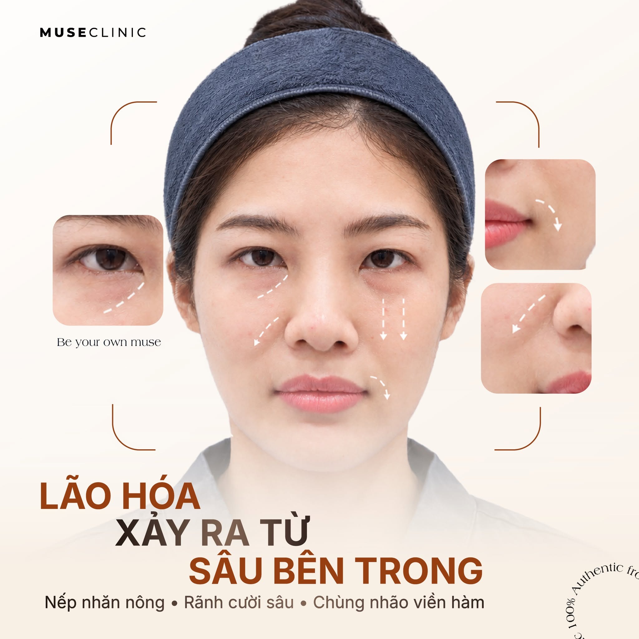 Mẹ bỉm sau sinh: 5 vấn đề về nhan sắc thường gặp