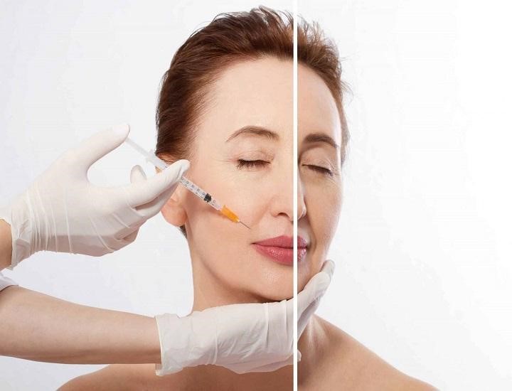 Có giới hạn bao nhiêu tuổi thì được tiêm Botox không?