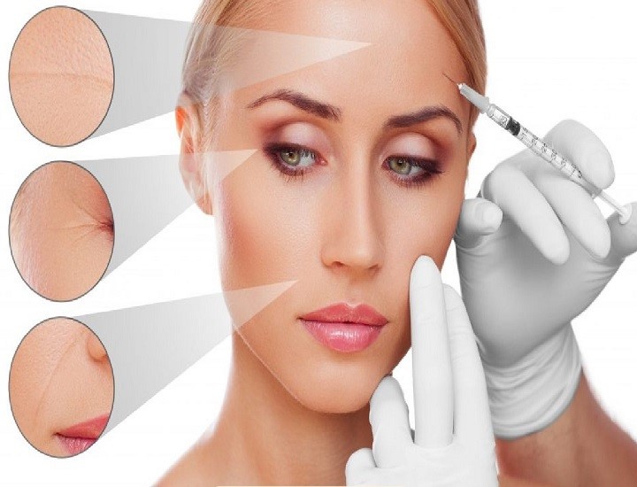 So sánh Botox và filler khác nhau như thế nào?