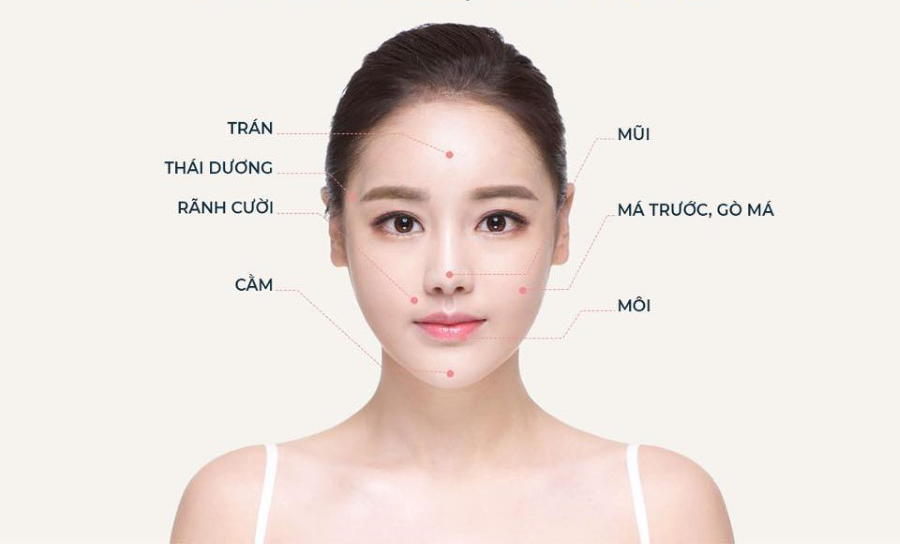 Các vị trí tiêm filler trên mặt cải thiện vẻ đẹp hiệu quả nhất