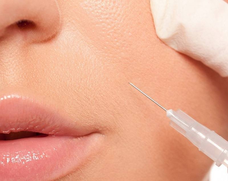 Rãnh cười đẹp hay xấu? Cách làm đầy rãnh cười tự nhiên bằng Botox