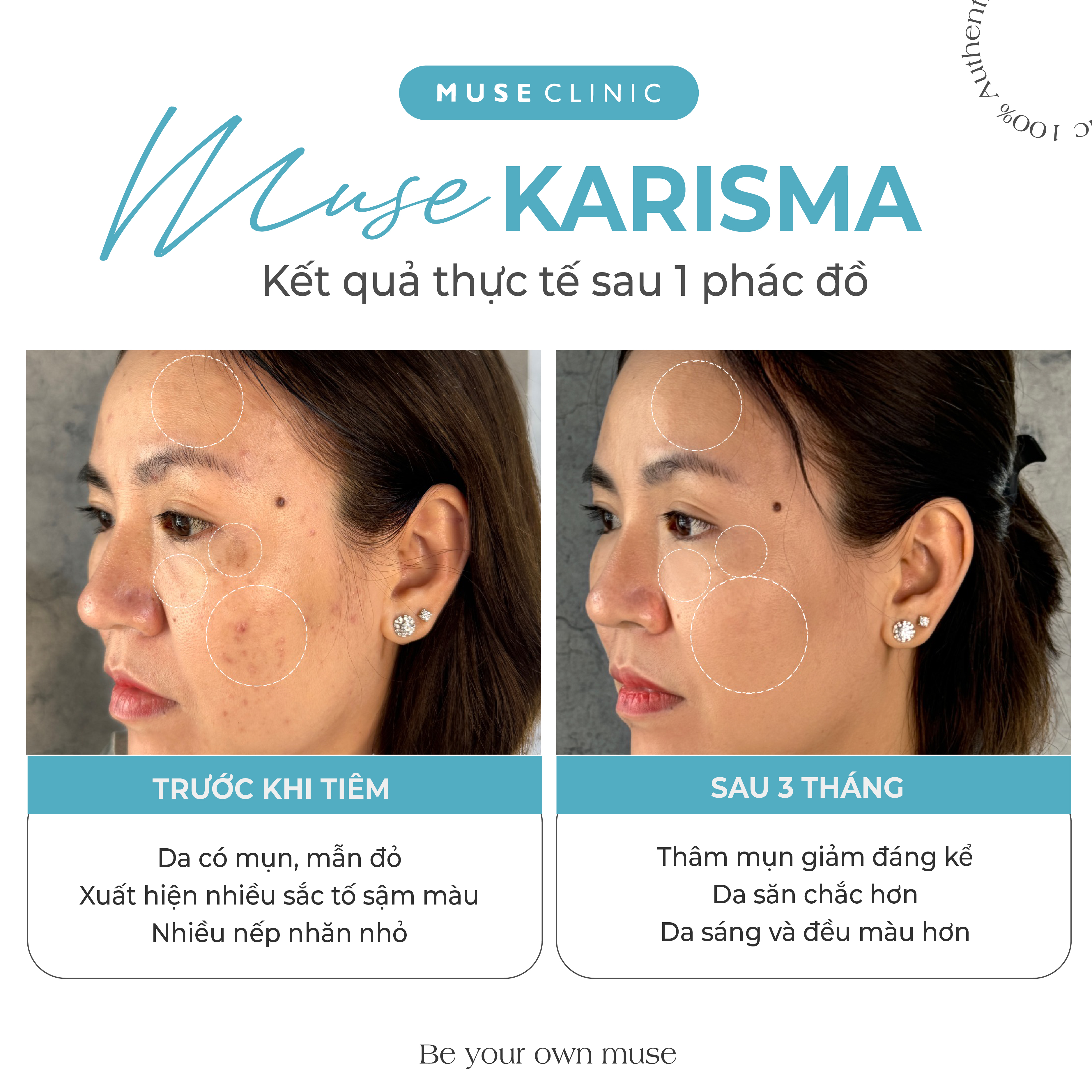 Karisma Rh Collagen – Bí quyết trẻ hóa da tự nhiên