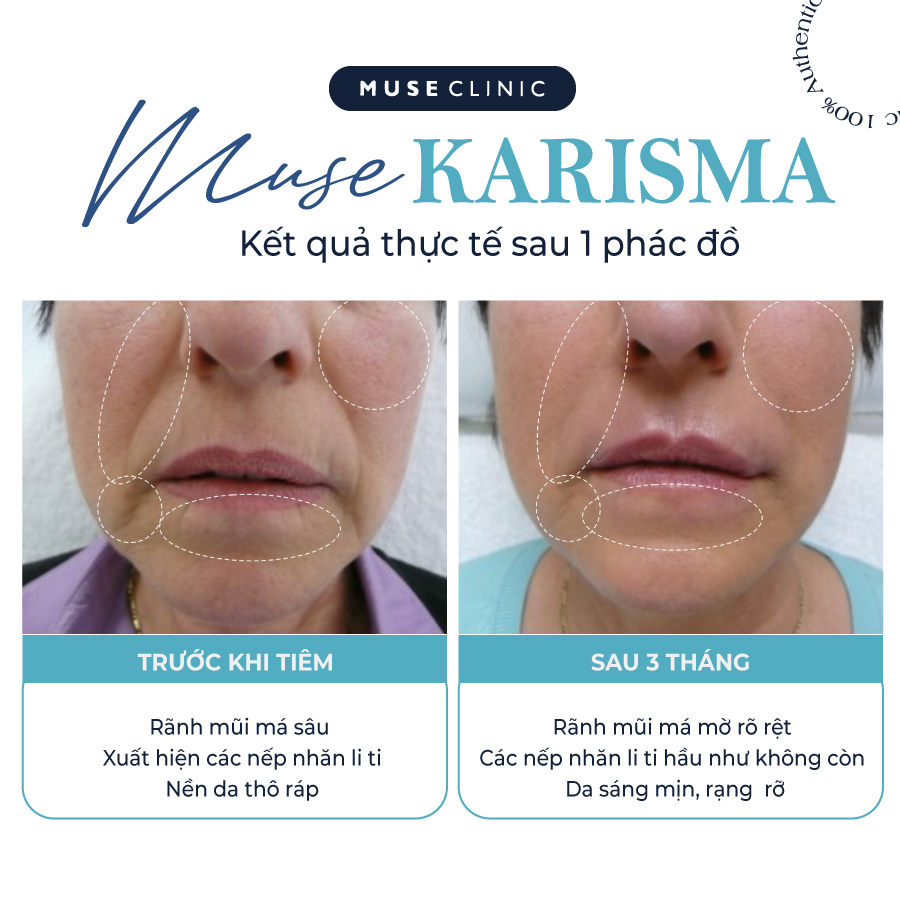 Karisma Rh Collagen – Bí quyết trẻ hóa da tự nhiên
