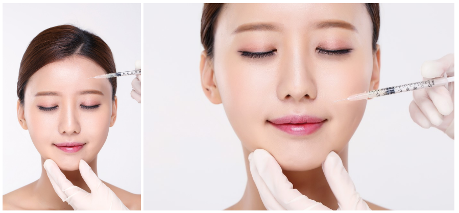 Giải pháp tiêm botox xóa nhăn trán cho làn da mịn màng