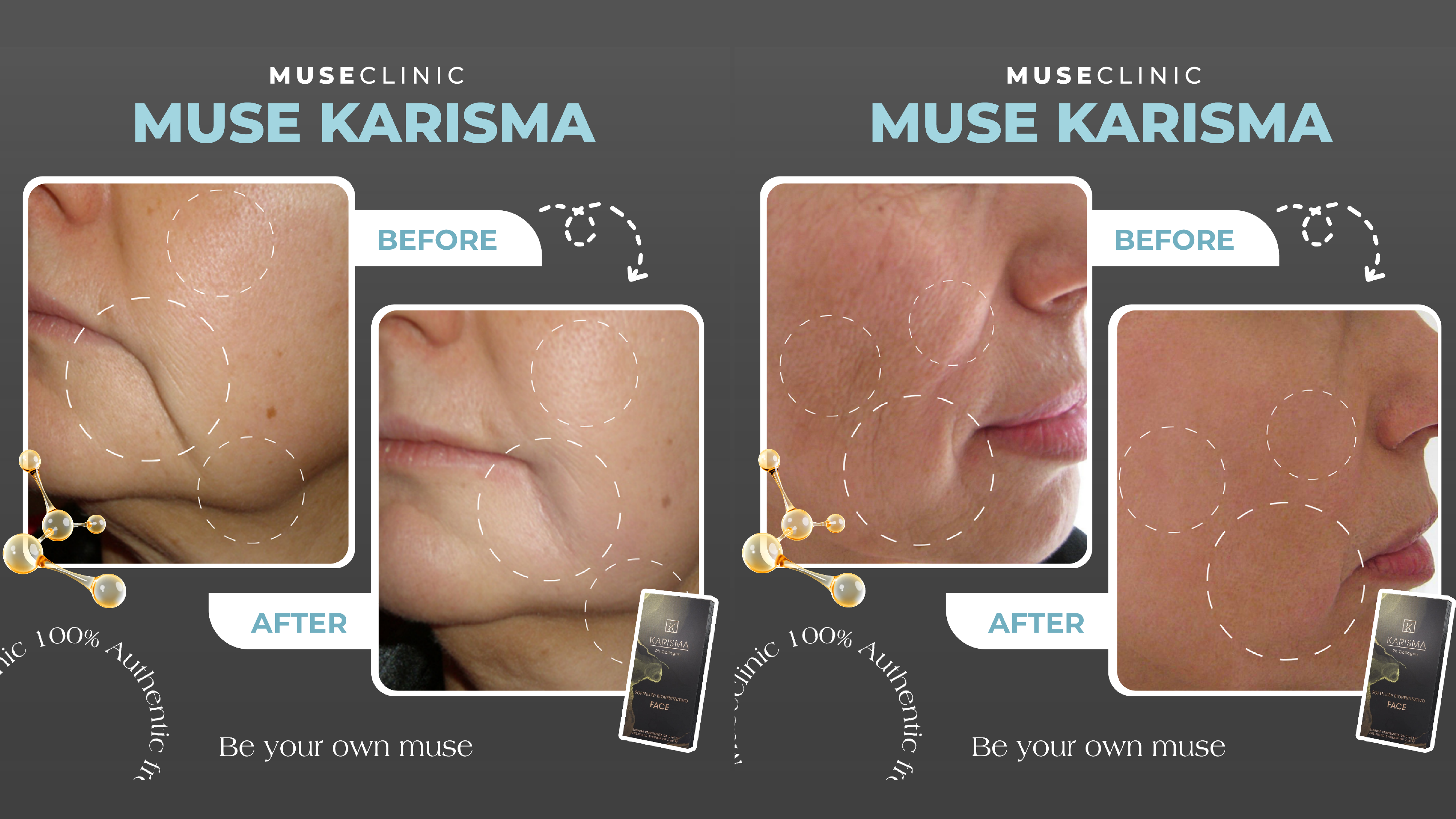 Karisma Rh Collagen – Bí quyết ngăn lão hoá da tự nhiên