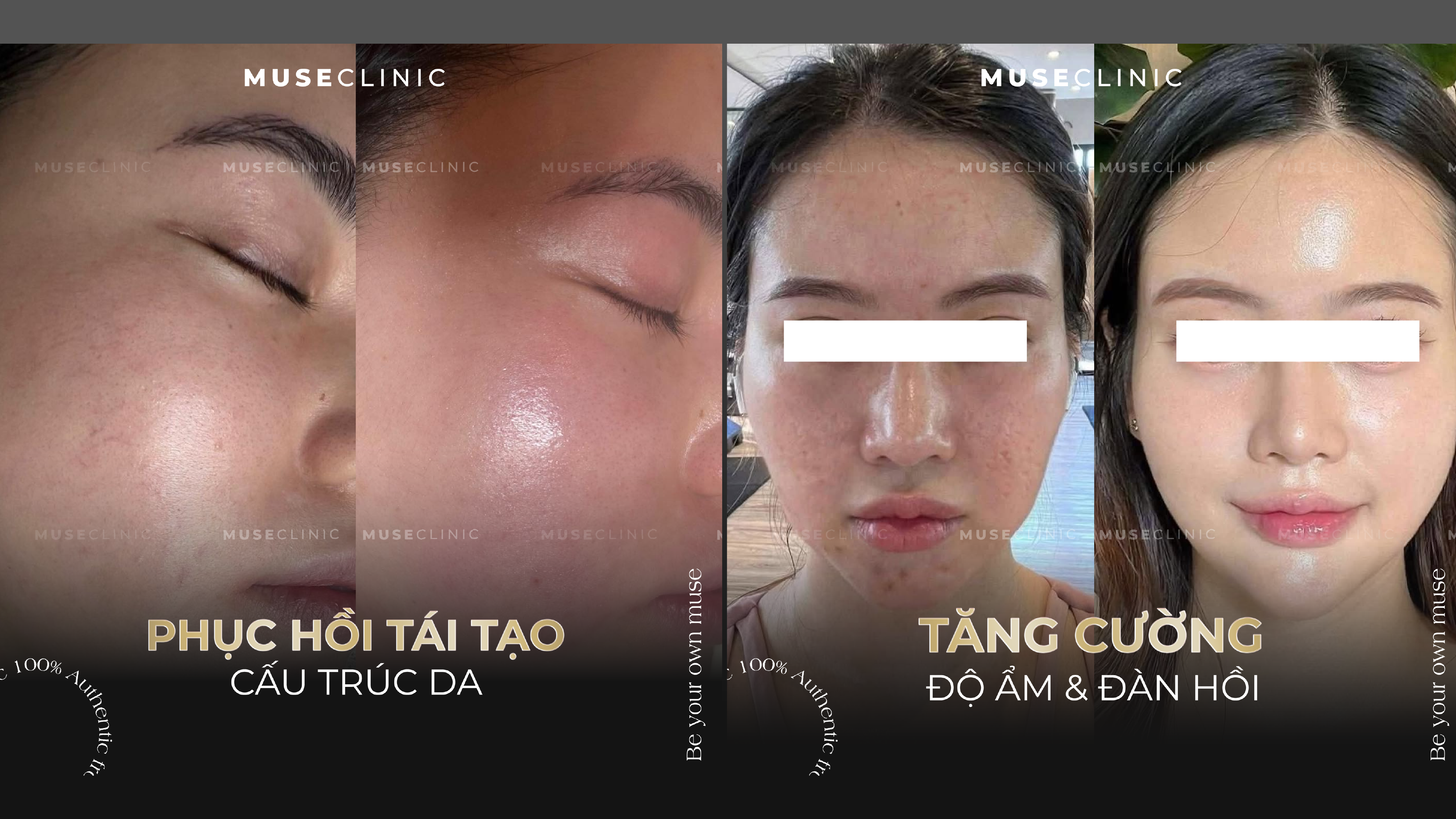 Karisma Rh Collagen – Bí quyết ngăn lão hoá da tự nhiên