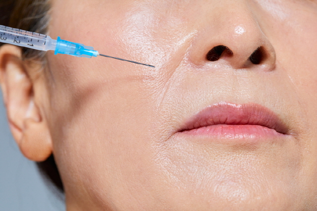 Có nên tiêm botox xóa nhăn để lấy lại sự trẻ trung?