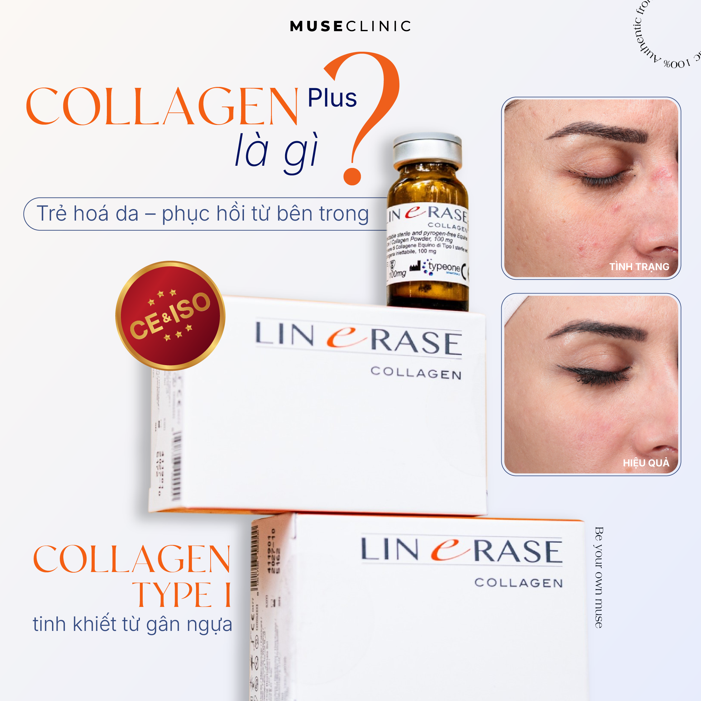 Linersae Collagen - Giải pháp trẻ hóa sinh học chuẩn y khoa Châu Âu giúp tái tạo làn da từ bên trong 