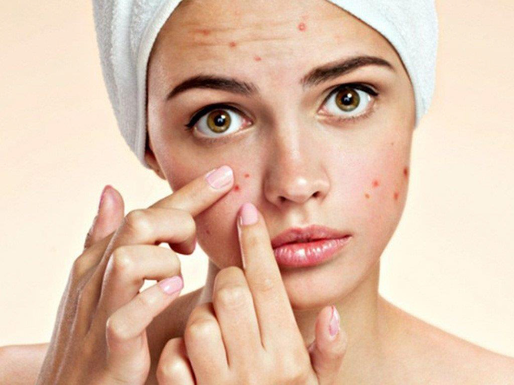 Thâm Mụn Lâu Mờ: Nguyên Nhân Và Cách Cải Thiện Hiệu Quả