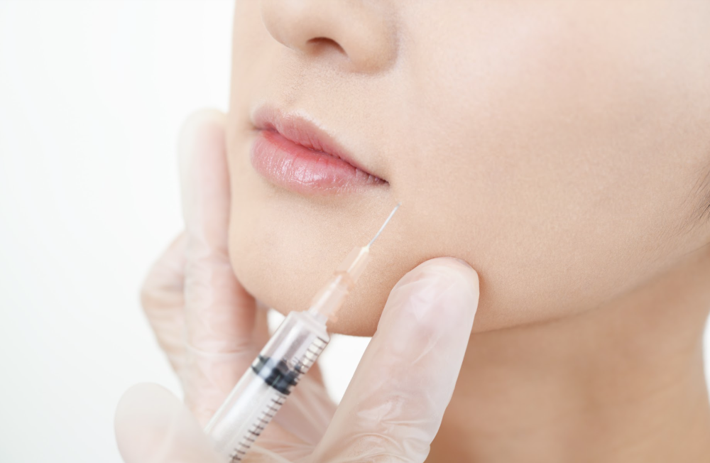 Tại sao nên tiêm Botox rãnh cười để khắc phục lão hóa da?