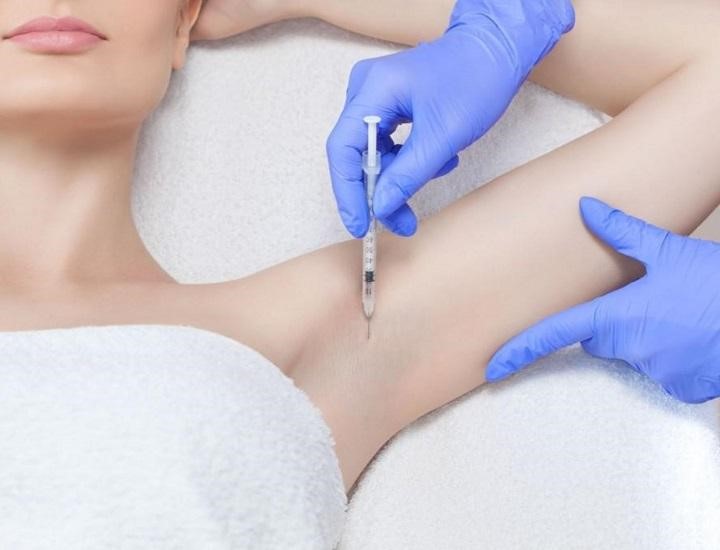 Tiêm Botox trị hôi nách bao lâu thì có tác dụng?