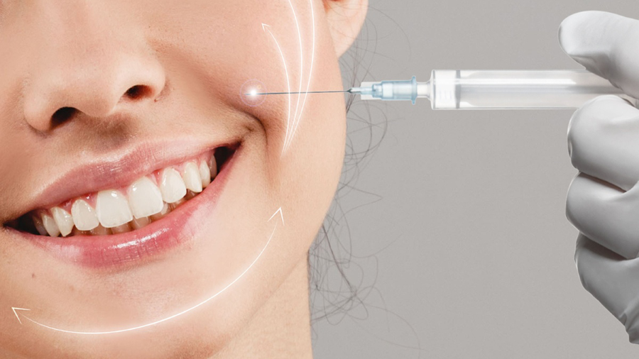 Liệu trình tiêm filler làm đầy rãnh cười xóa nếp nhăn hiệu quả