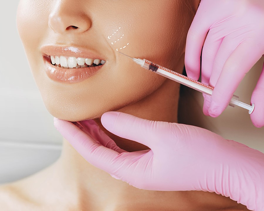 Liệu trình tiêm filler làm đầy rãnh cười xóa nếp nhăn hiệu quả