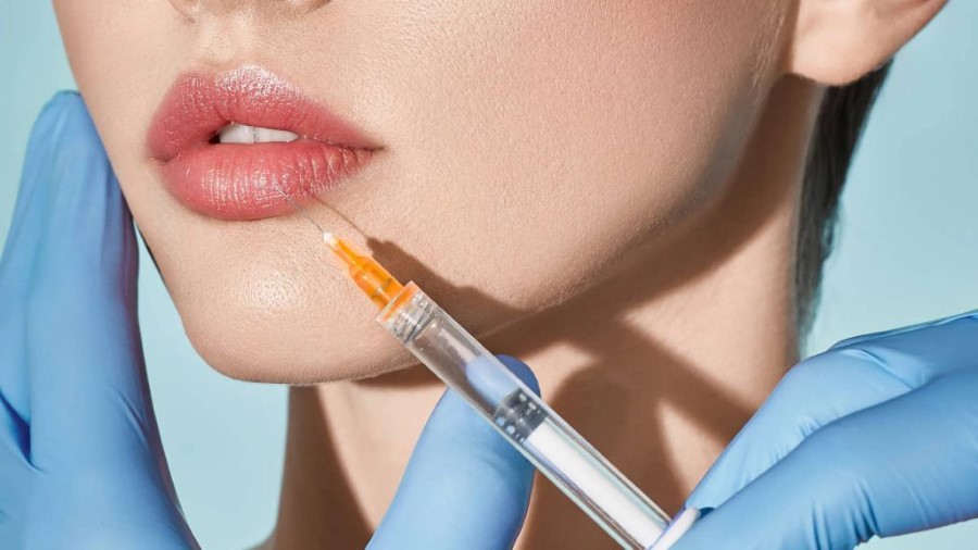 Tư vấn chọn loại filler phù hợp để tạo dáng môi Tây quyến rũ