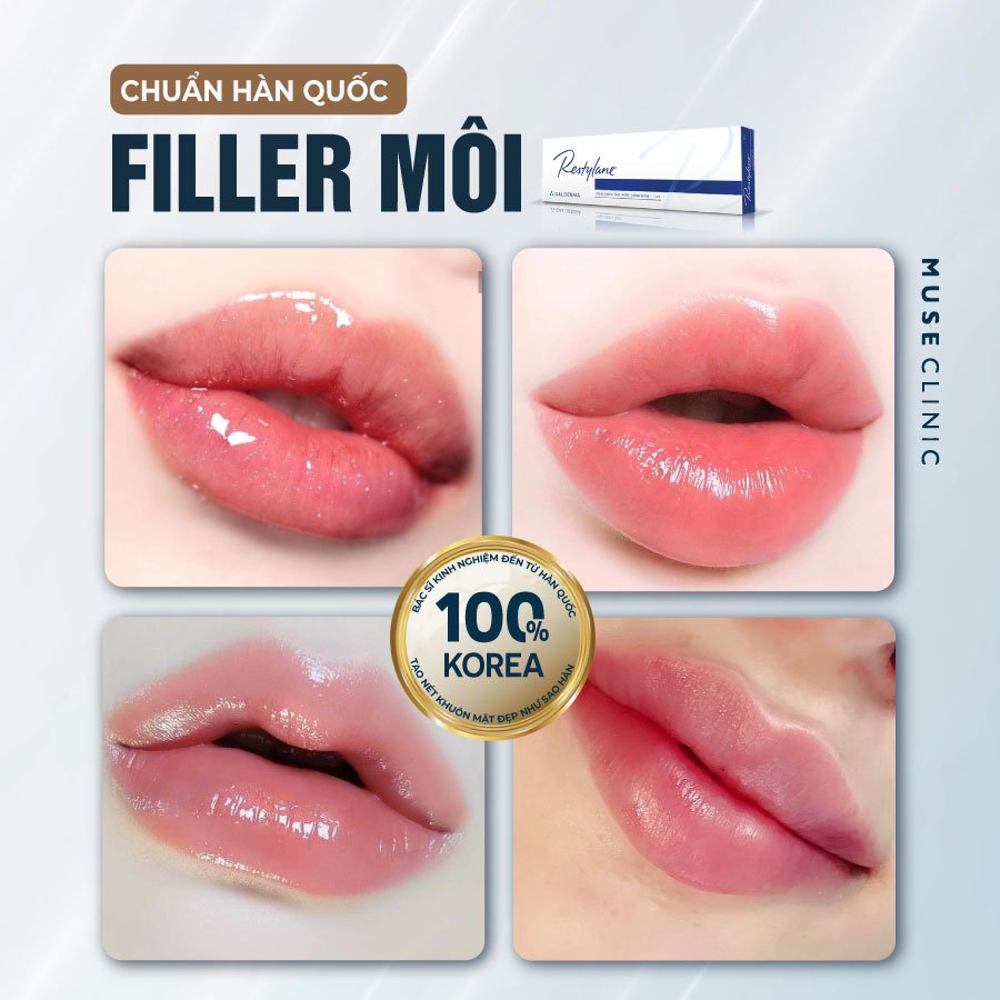 Tiêm filler môi trái tim sao cho đẹp và tự nhiên nhất?