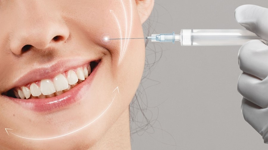 Tiêm filler rãnh cười sâu nên chọn loại nào tốt?