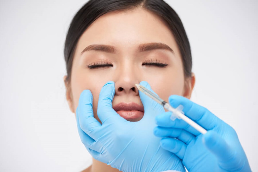 Tại sao tiêm filler thu nhỏ đầu mũi là lựa chọn phổ biến?