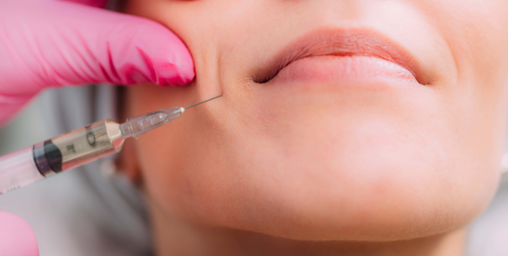 Có nên tiêm rãnh cười bằng Botox không? Ưu và nhược điểm