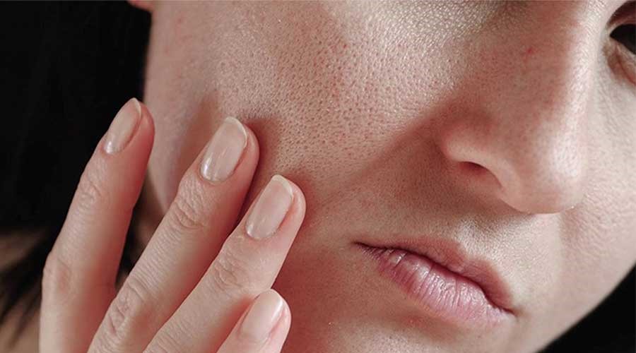 Da khô chảy xệ: Nguyên nhân và cách khắc phục hiệu quả