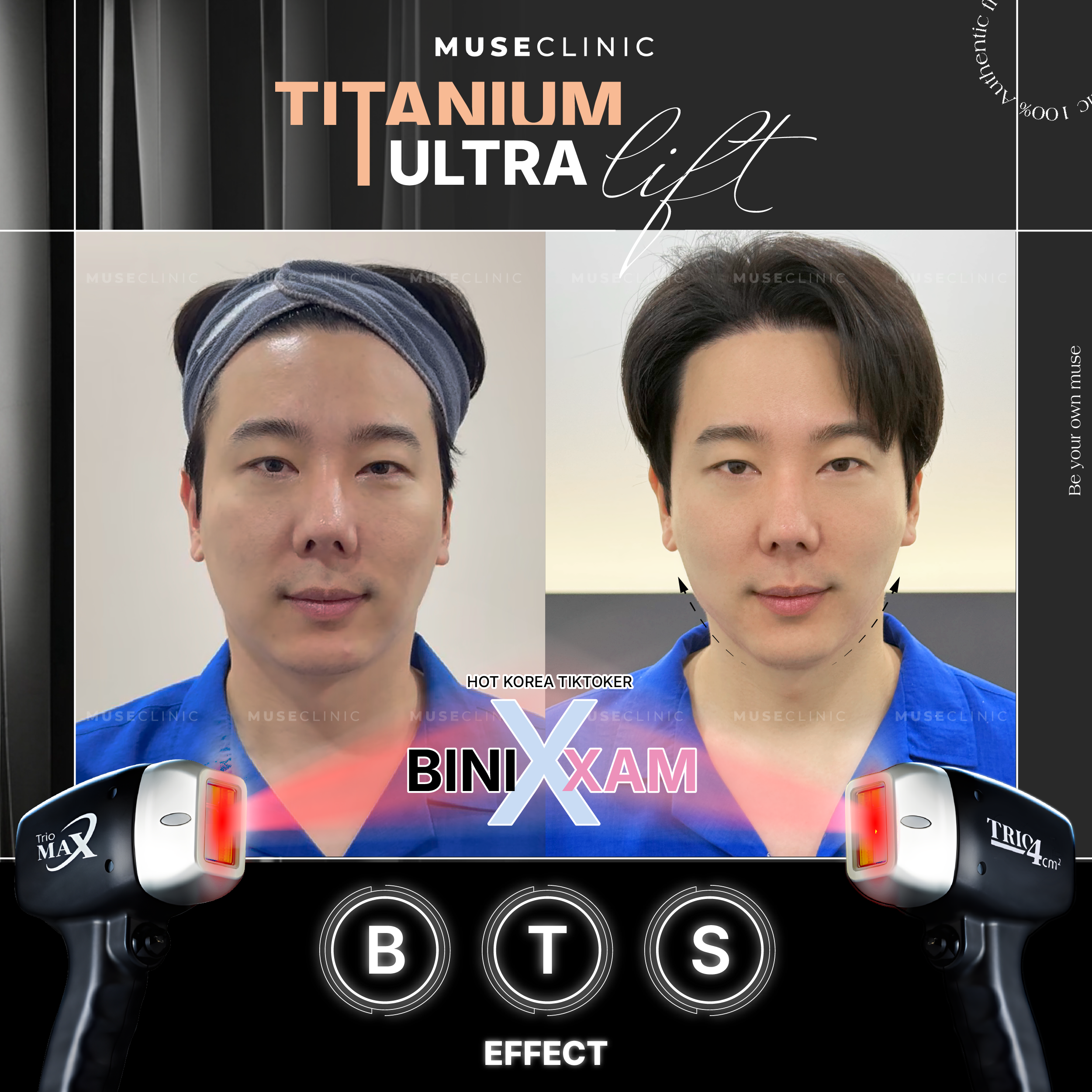 Giải Mã Muse Titanium Ultralift – Phác Đồ Trẻ Lâu Của Sao Hàn
