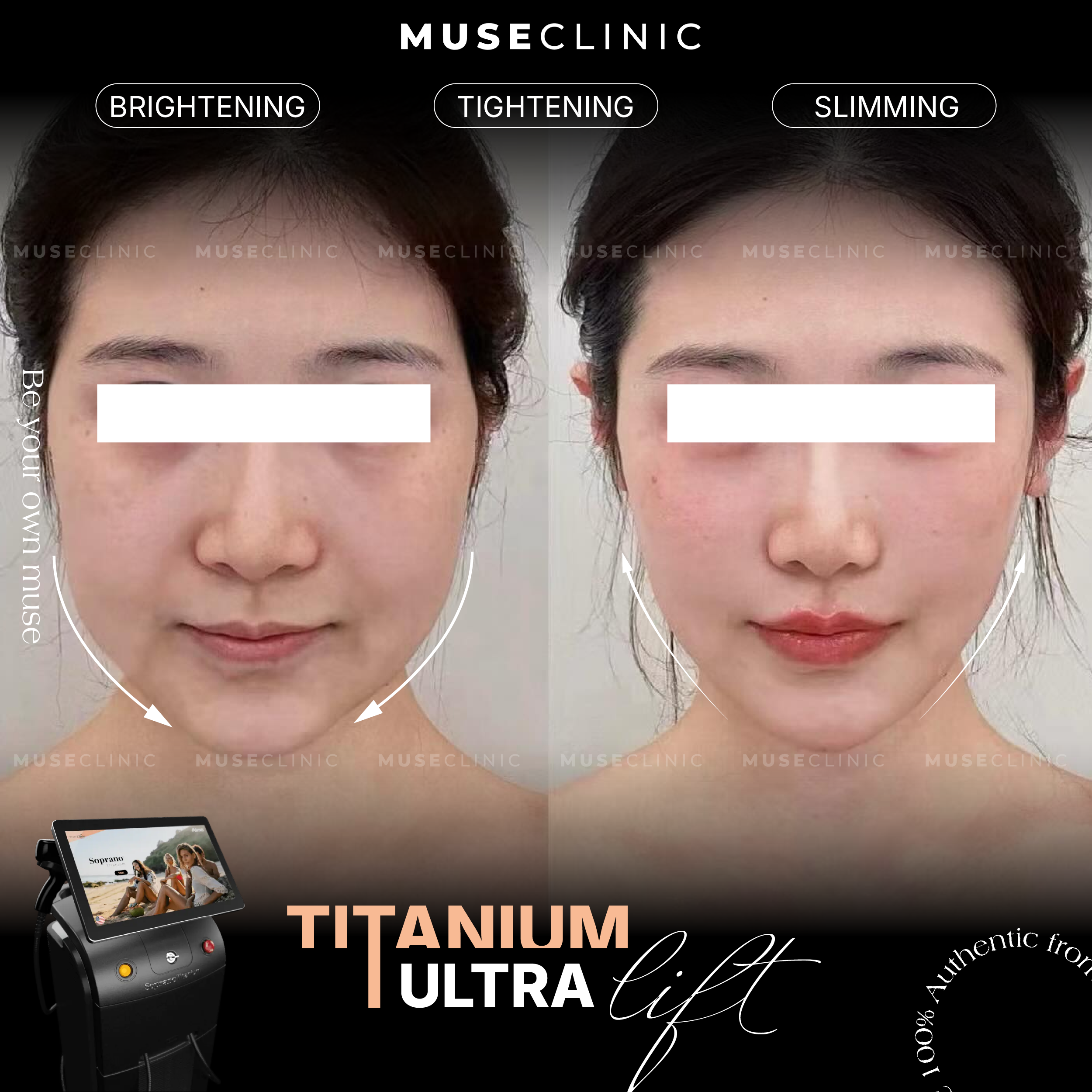 Giải Mã Muse Titanium Ultralift – Phác Đồ Trẻ Lâu Của Sao Hàn