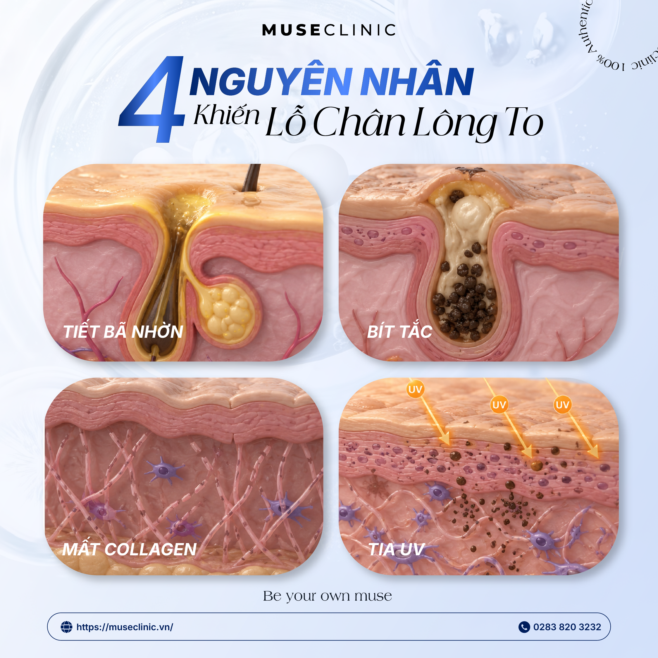 Tại Sao Lỗ Chân Lông Càng Ngày Càng To Và Cách Khắc Phục Hiệu Quả?