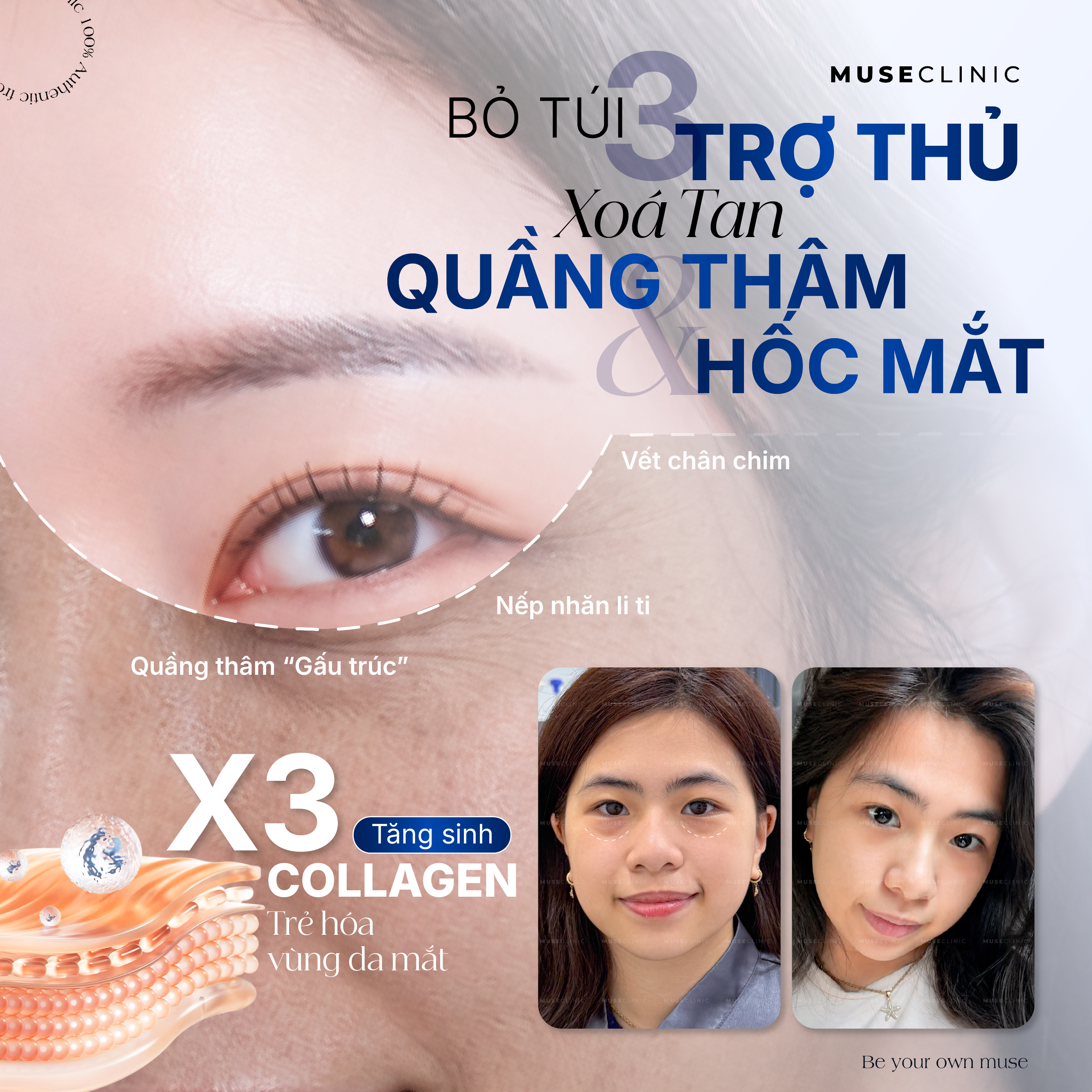 BỘ 3 TRẺ HÓA VÙNG MẮT THẾ HỆ MỚI KHÔNG CẦN PHẪU THUẬT - GIẢI PHÁP CHO ĐÔI MẮT TƯƠI TRẺ TỰ NHIÊN 