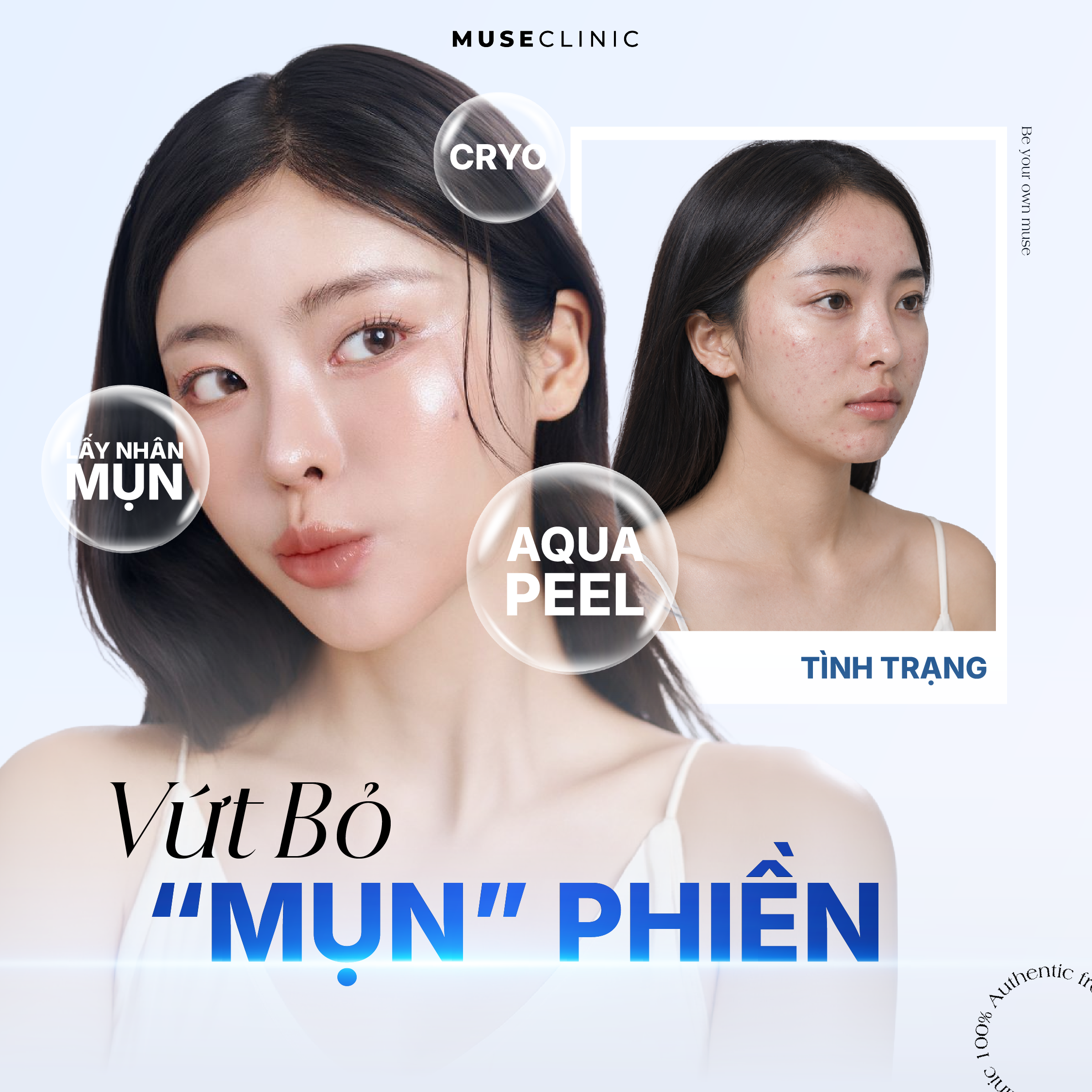 Tại Sao Lỗ Chân Lông Càng Ngày Càng To Và Cách Khắc Phục Hiệu Quả?