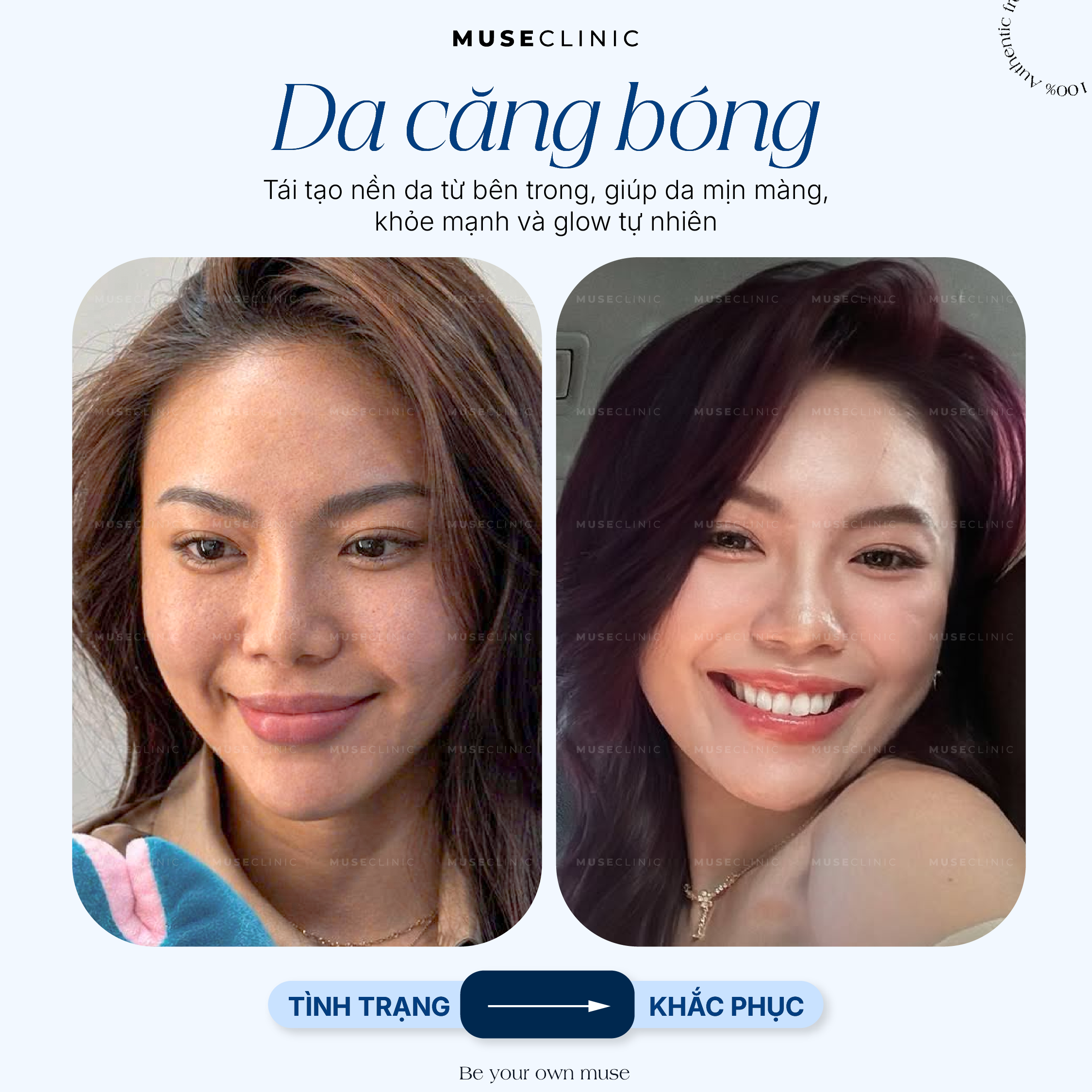 Da Căng Bóng - Biểu Hiện Của Một Làn Da Khỏe & Đẹp, Không Chỉ Là Hiệu Ứng Bề Mặt! 