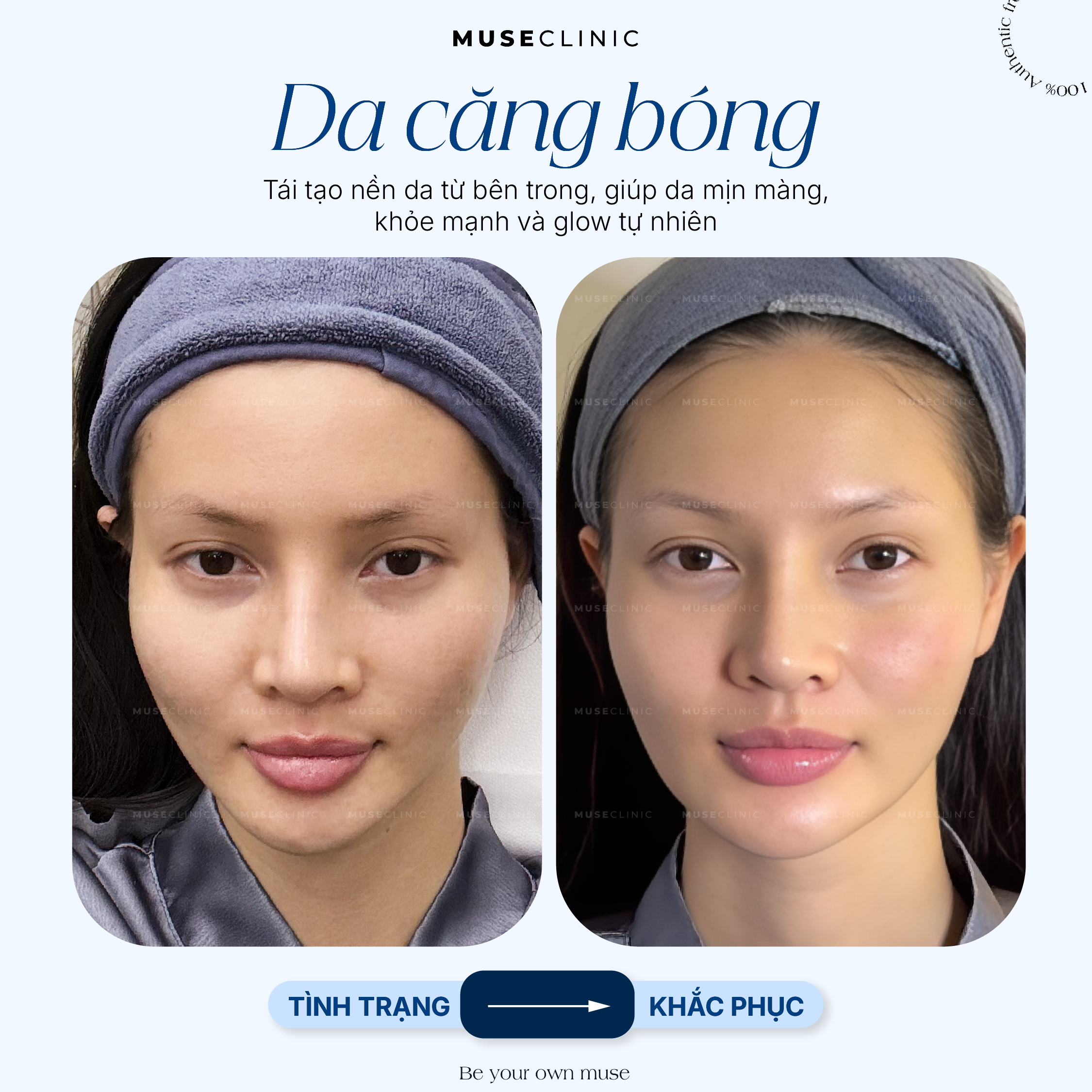 Da Căng Bóng - Biểu Hiện Của Một Làn Da Khỏe & Đẹp, Không Chỉ Là Hiệu Ứng Bề Mặt! 