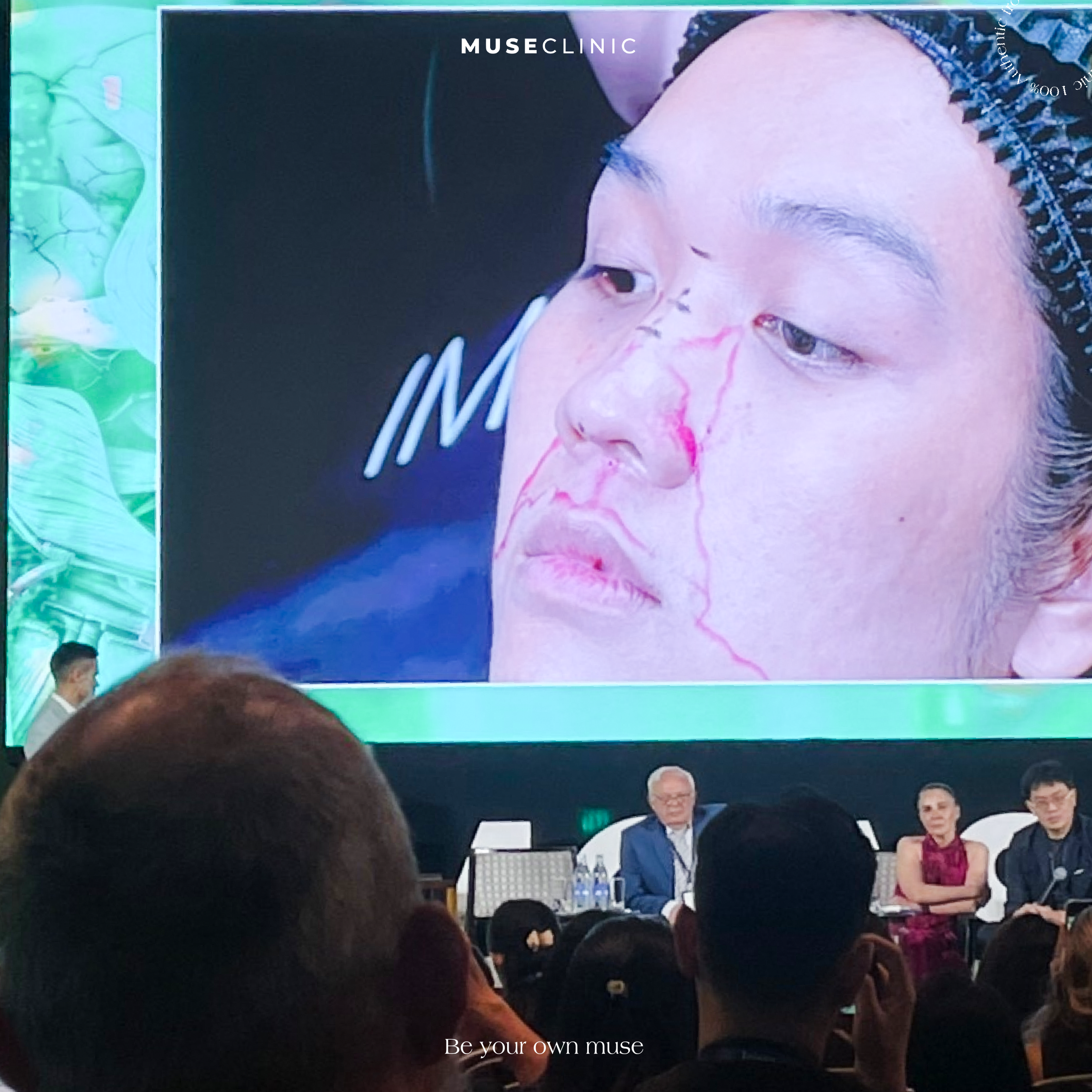 MUSE CLINIC VIETNAM TẠI IMCAS ASIA 2026: TIẾP CẬN & ỨNG DỤNG XU HƯỚNG TRẺ HÓA LÀN DA THẾ HỆ MỚI, CHUẨN QUỐC TẾ
