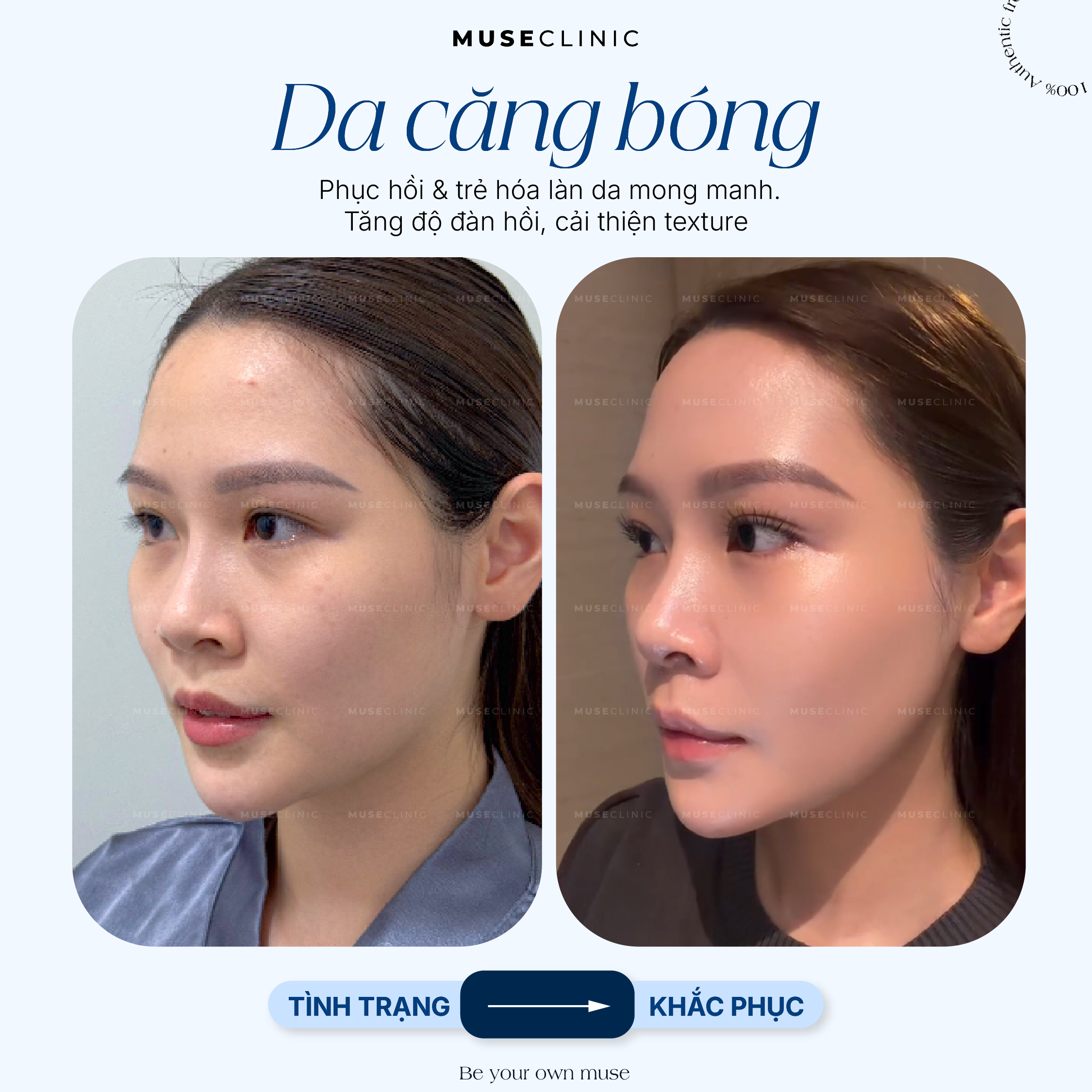 Da Căng Bóng - Biểu Hiện Của Một Làn Da Khỏe & Đẹp, Không Chỉ Là Hiệu Ứng Bề Mặt! 