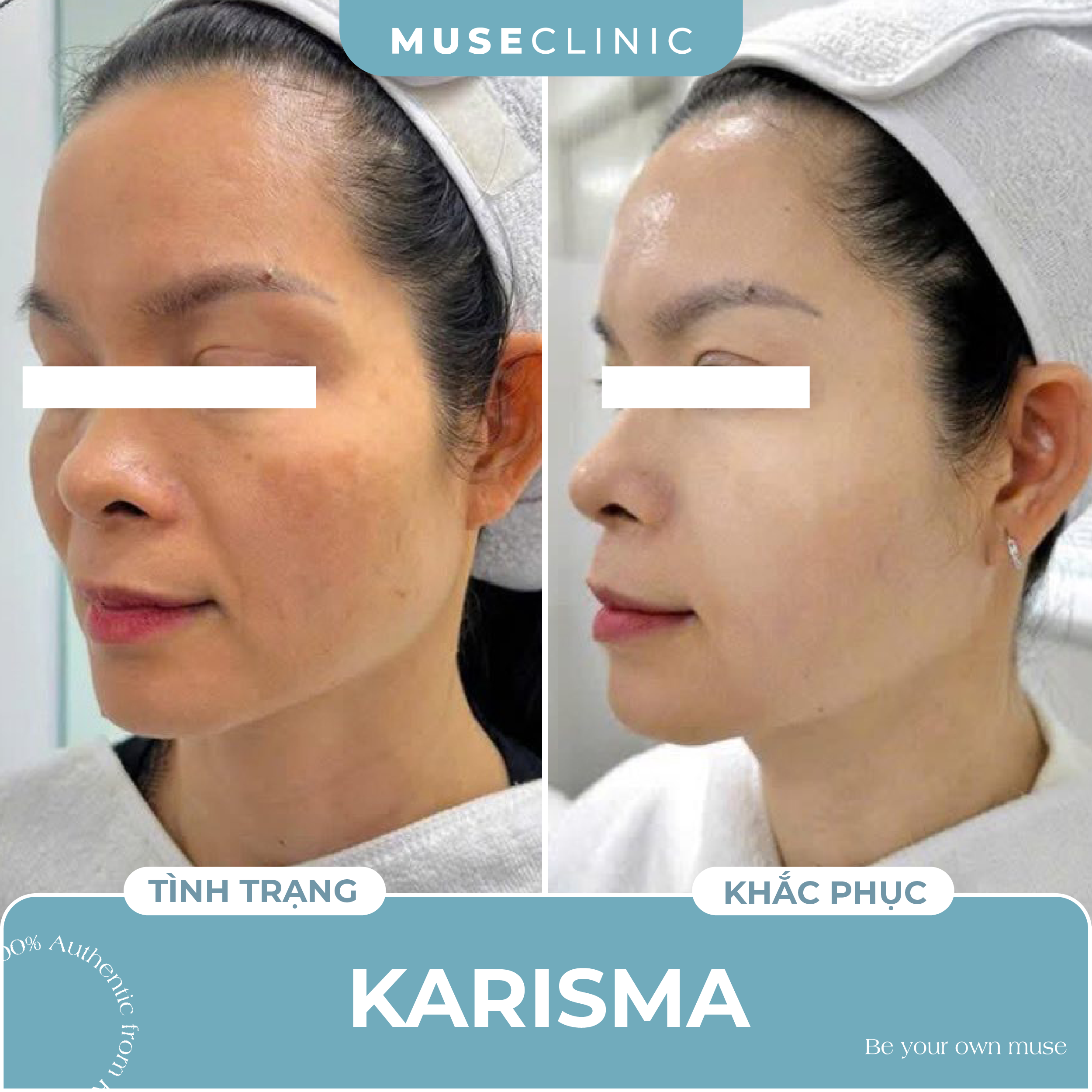 Karisma Rh Collagen – Bí quyết trẻ hóa da tự nhiên