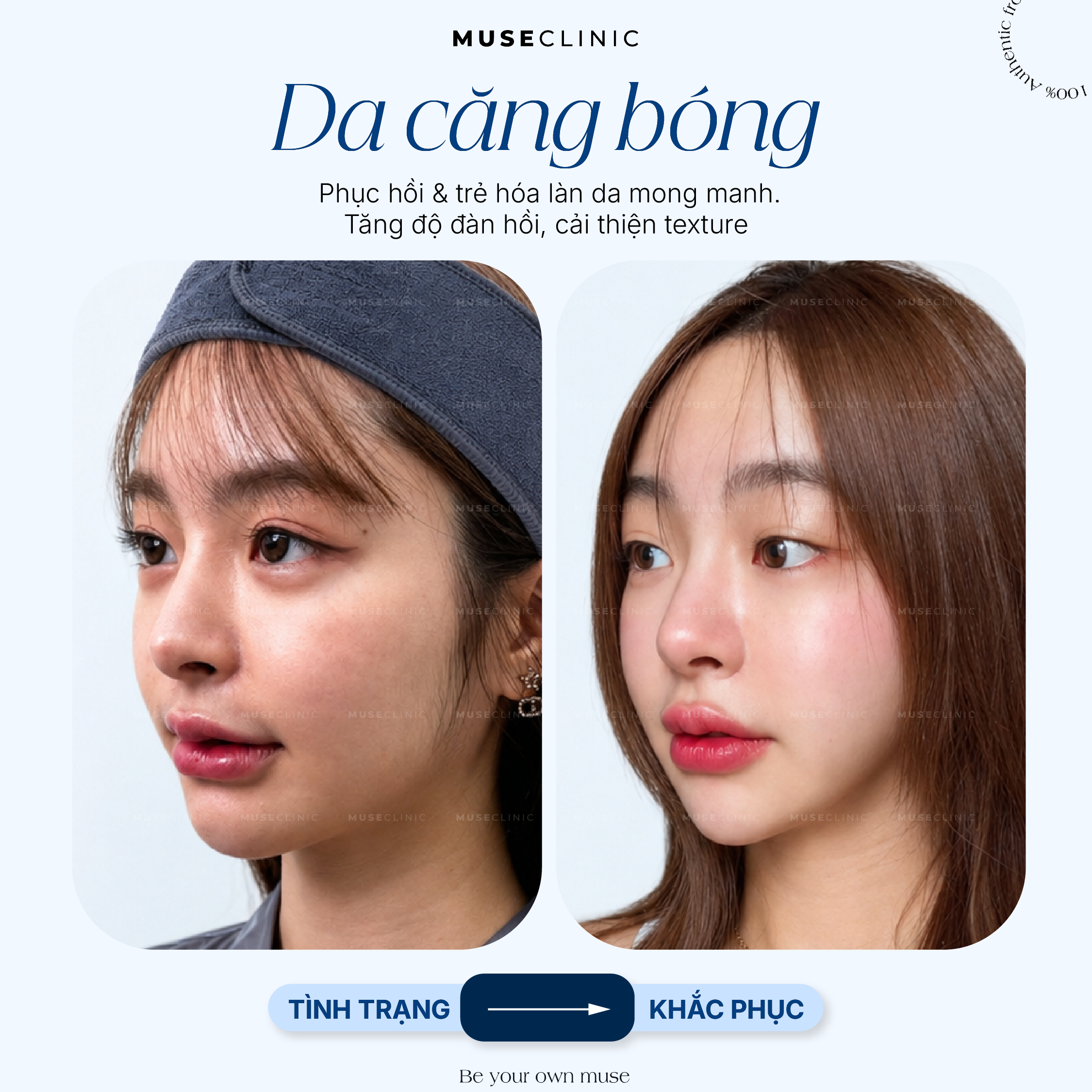 Da Căng Bóng - Biểu Hiện Của Một Làn Da Khỏe & Đẹp, Không Chỉ Là Hiệu Ứng Bề Mặt! 