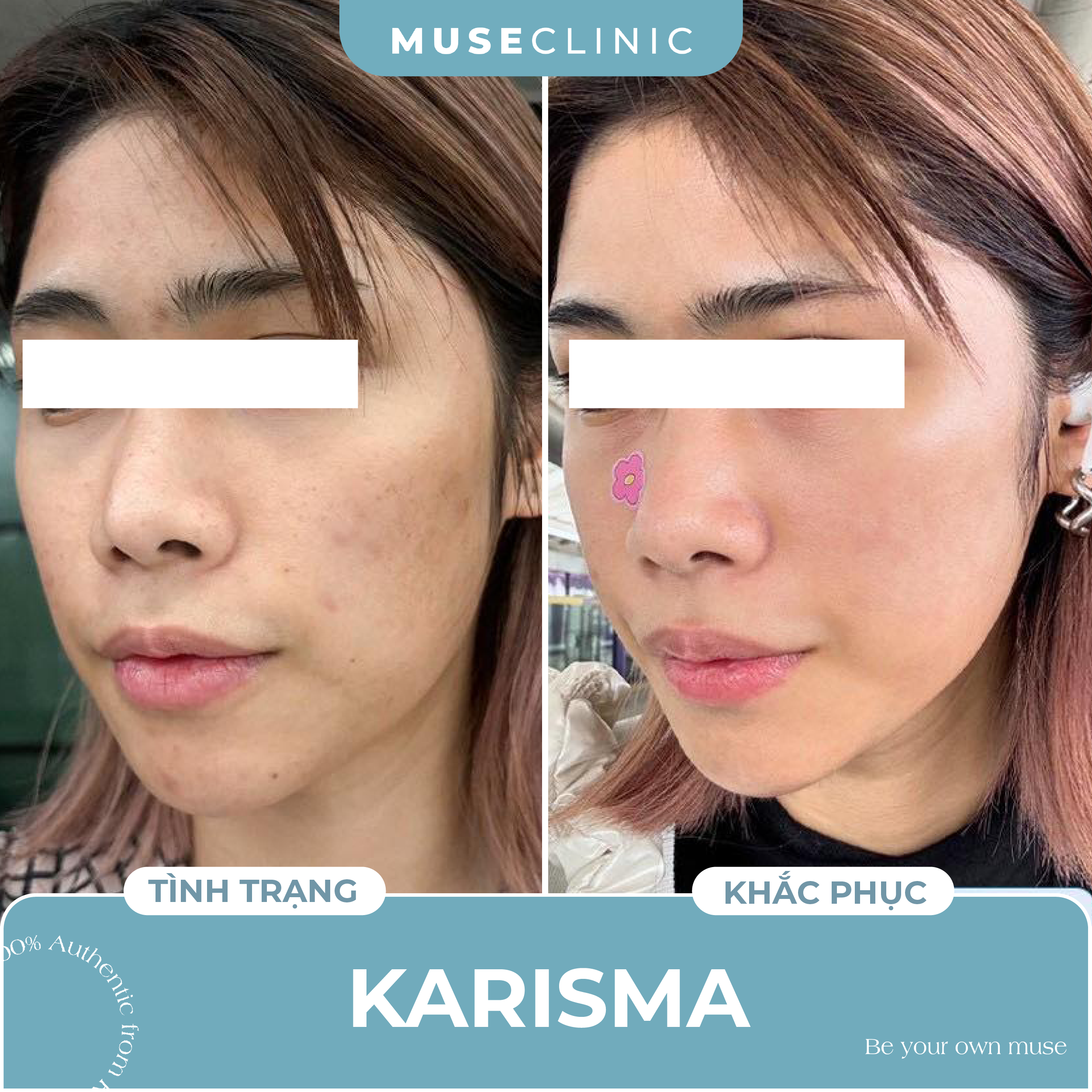 Karisma Rh Collagen – Bí quyết trẻ hóa da tự nhiên