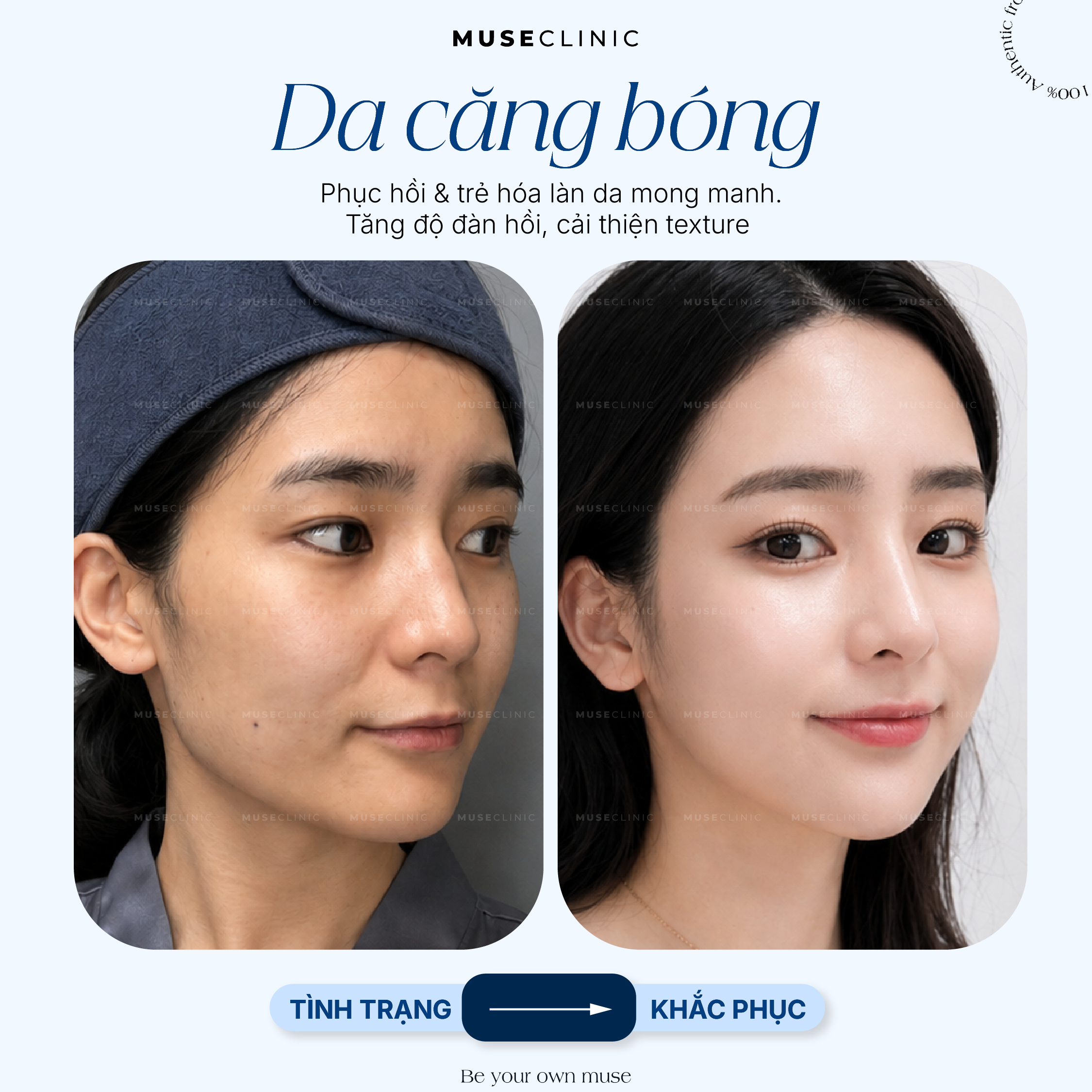 Da Căng Bóng - Biểu Hiện Của Một Làn Da Khỏe & Đẹp, Không Chỉ Là Hiệu Ứng Bề Mặt! 