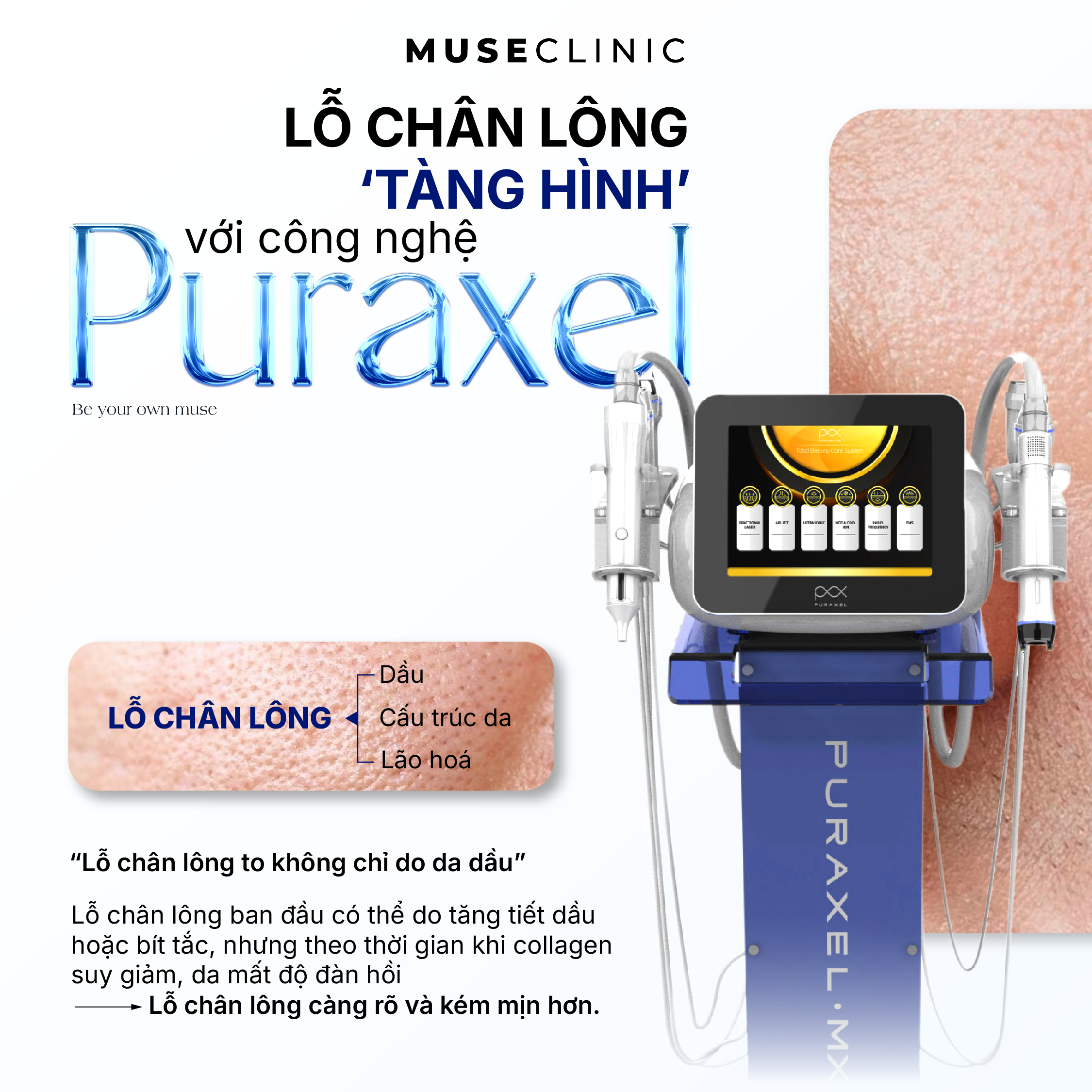 Puraxel - Công nghệ “Meso không kim” giúp cải thiện đa tầng, làm mịn và tăng độ đàn hồi da