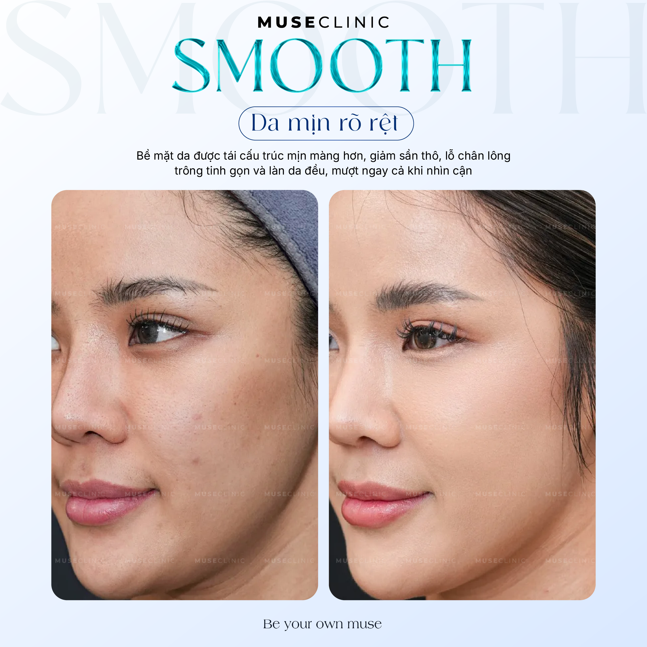 Da khô, sần sùi và thiếu sức sống? Khám phá SKINVIVE - “Vũ khí'' Skin Booster thế hệ mới giúp tái thiết chất lượng da từ bên trong