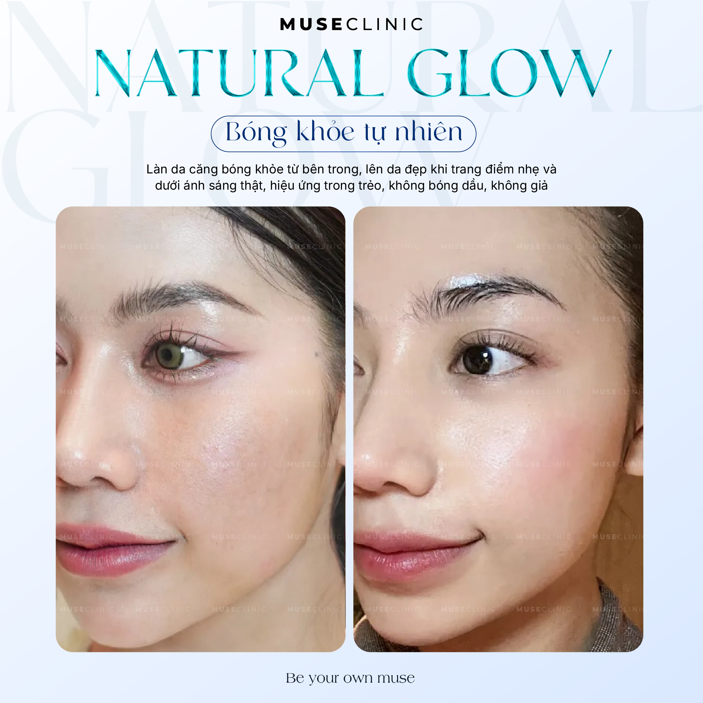 Da khô, sần sùi và thiếu sức sống? Khám phá SKINVIVE - “Vũ khí'' Skin Booster thế hệ mới giúp tái thiết chất lượng da từ bên trong