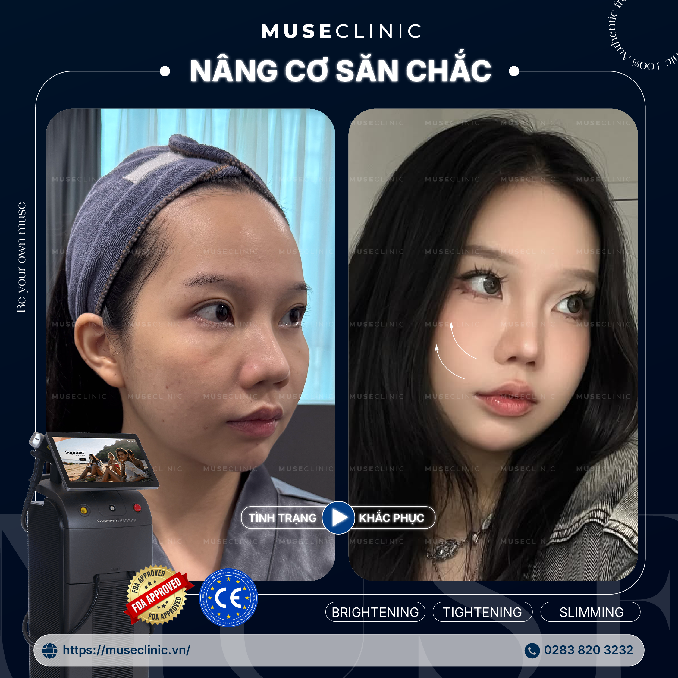 TITANIUM LIFTING – CƠ CHẾ TRẺ HÓA DA ĐỘT PHÁ 3 TRONG 1