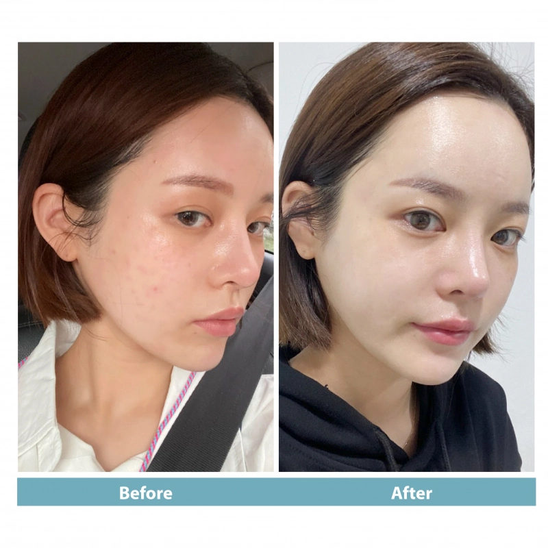 Crystal Skin Plus
